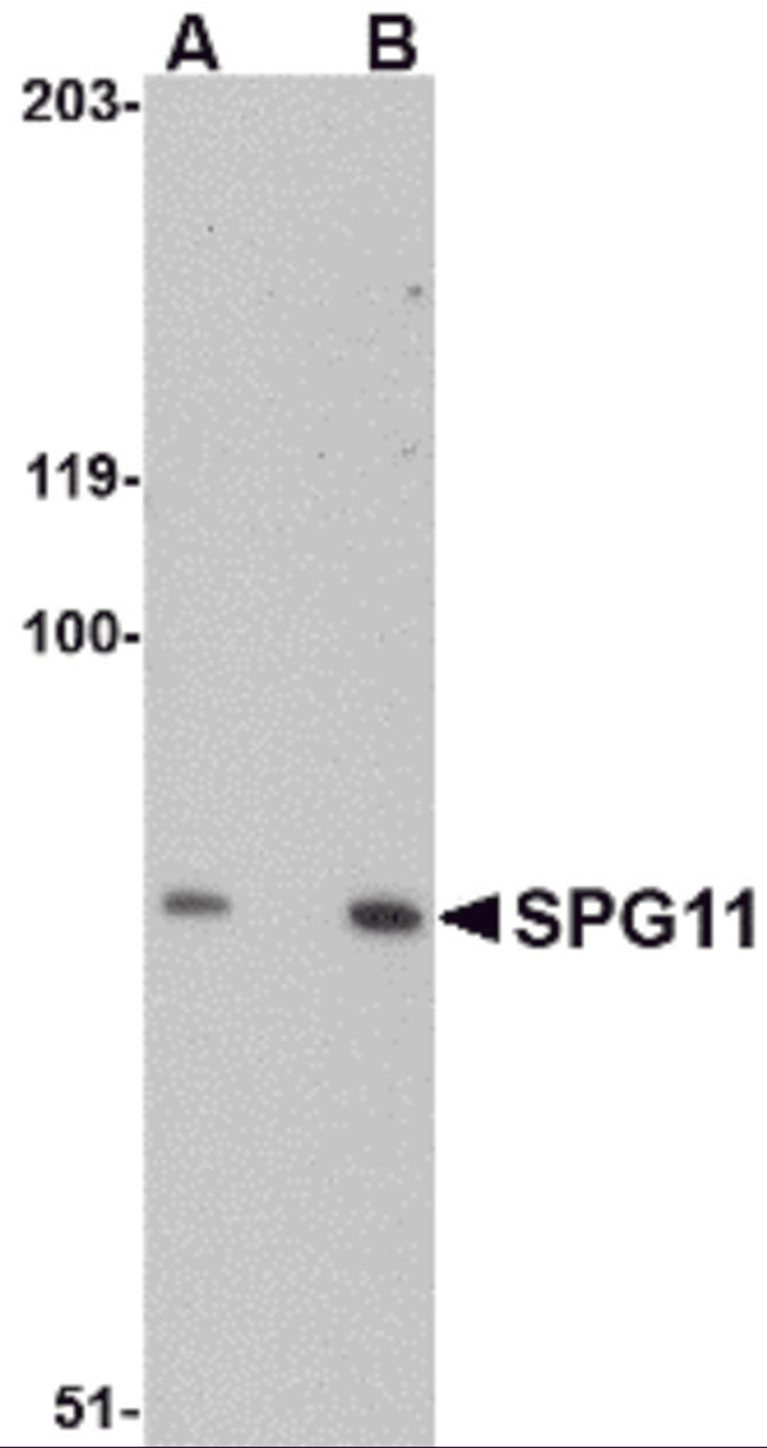 Western blot analysis of SPG11 in mouse heart tissue lysate with SPG11 antibody at (A) 0.5 and (B) 1 μg/mL.