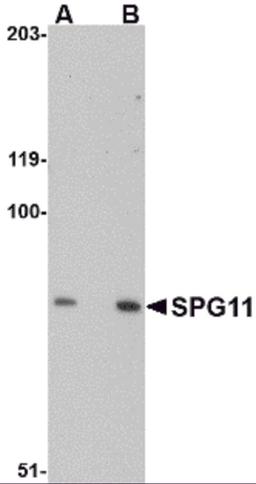 Western blot analysis of SPG11 in mouse heart tissue lysate with SPG11 antibody at (A) 0.5 and (B) 1 μg/mL.