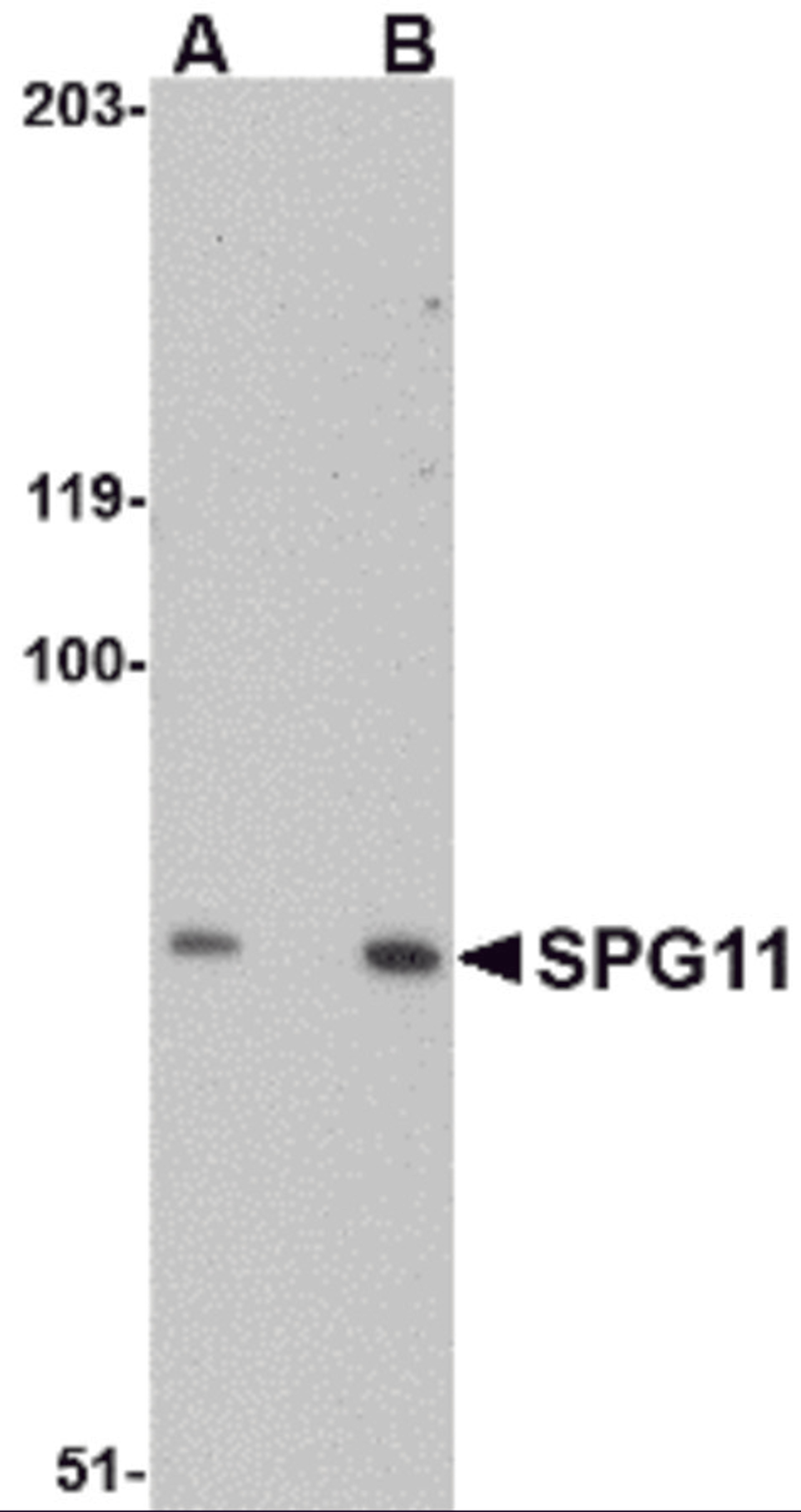 Western blot analysis of SPG11 in mouse heart tissue lysate with SPG11 antibody at (A) 0.5 and (B) 1 μg/mL.