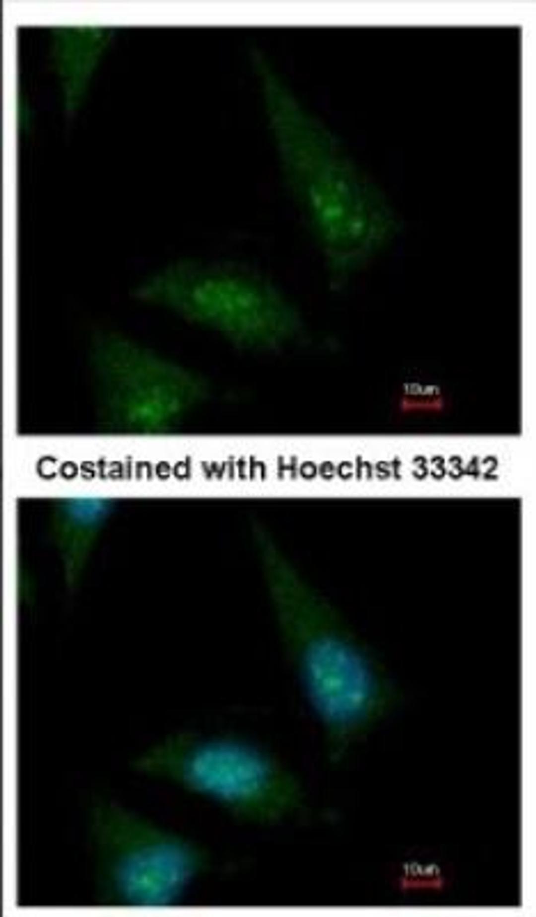 Immunocytochemistry/Immunofluorescence: CLASP1 Antibody [NBP2-15910] - Immunofluorescence analysis of methanol-fixed HeLa, using antibody at 1:500 dilution.