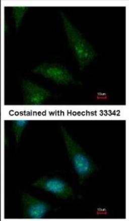 Immunocytochemistry/Immunofluorescence: CLASP1 Antibody [NBP2-15910] - Immunofluorescence analysis of methanol-fixed HeLa, using antibody at 1:500 dilution.