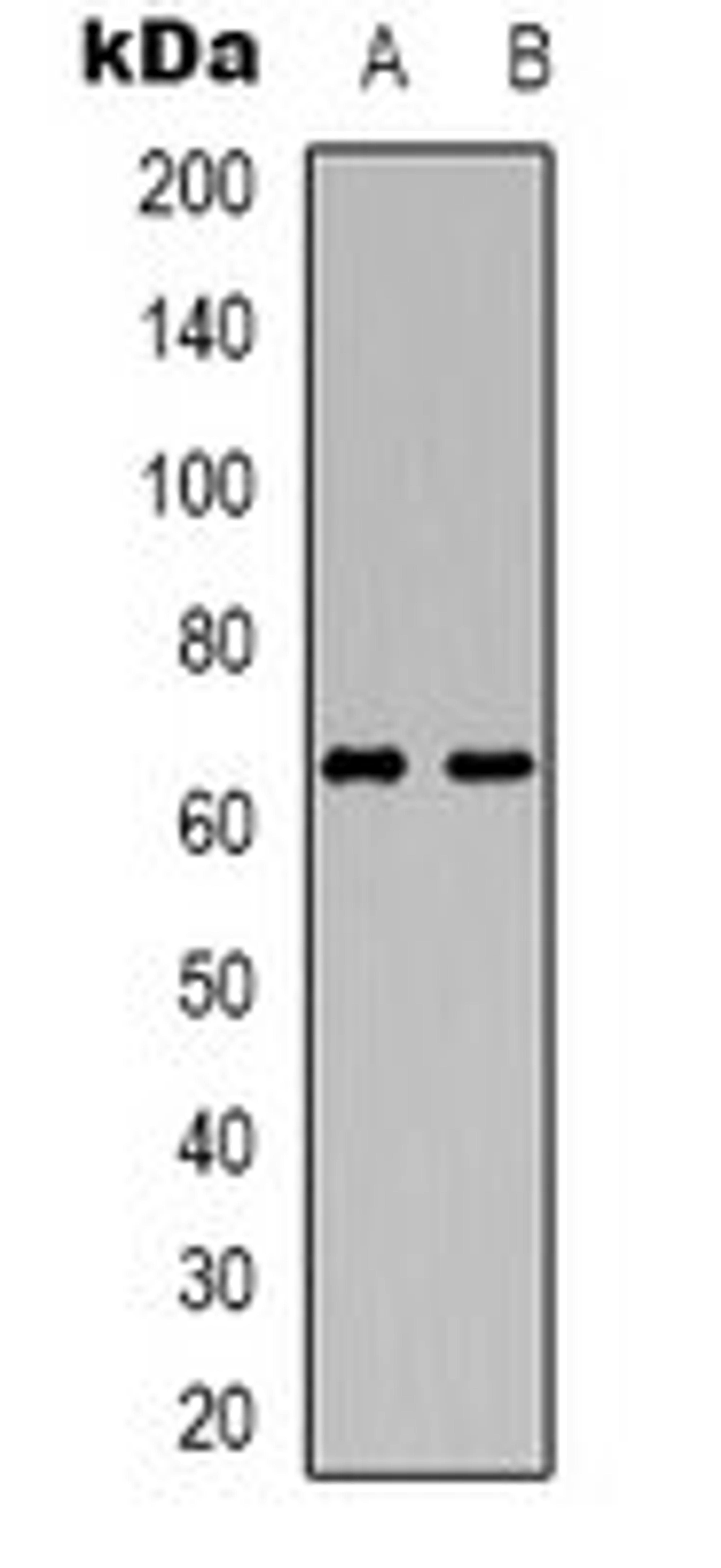 Western blot analysis of HuvEc (Lane 1), Jurkat (Lane 2) whole cell lysates using DCP1A antibody