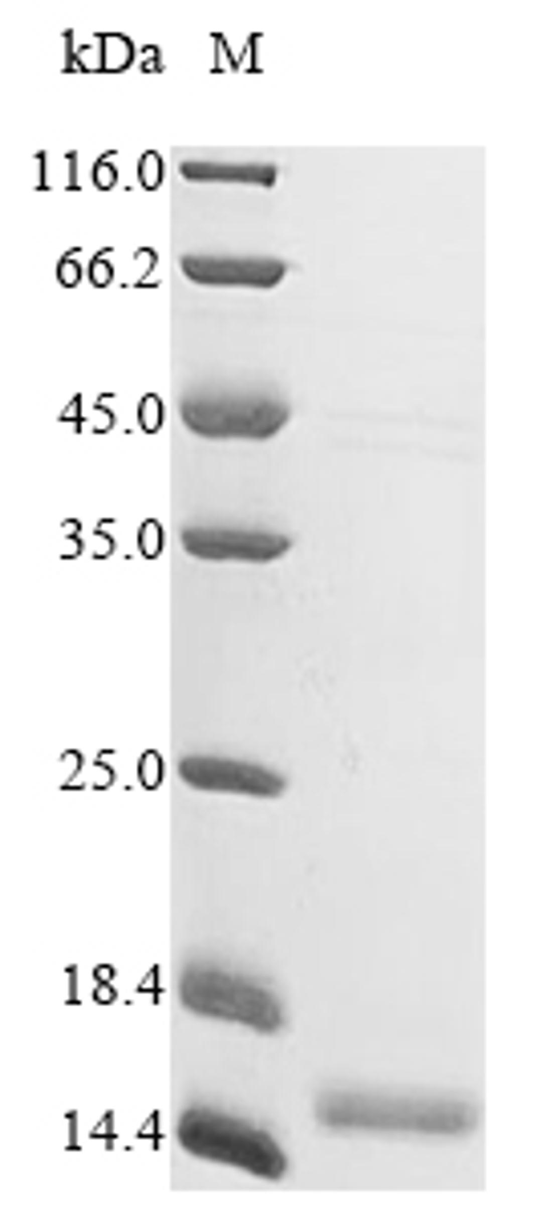 (Tris-Glycine gel) Discontinuous SDS-PAGE (reduced) with 5% enrichment gel and 15% separation gel.