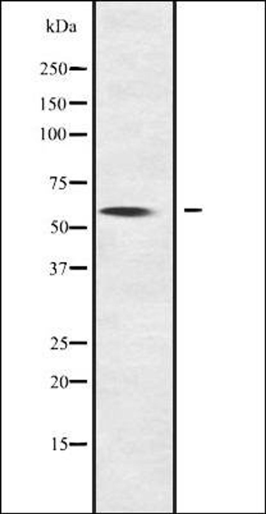 Western blot analysis of NOC4L transfected 293T cell lysate using NOC4L antibody