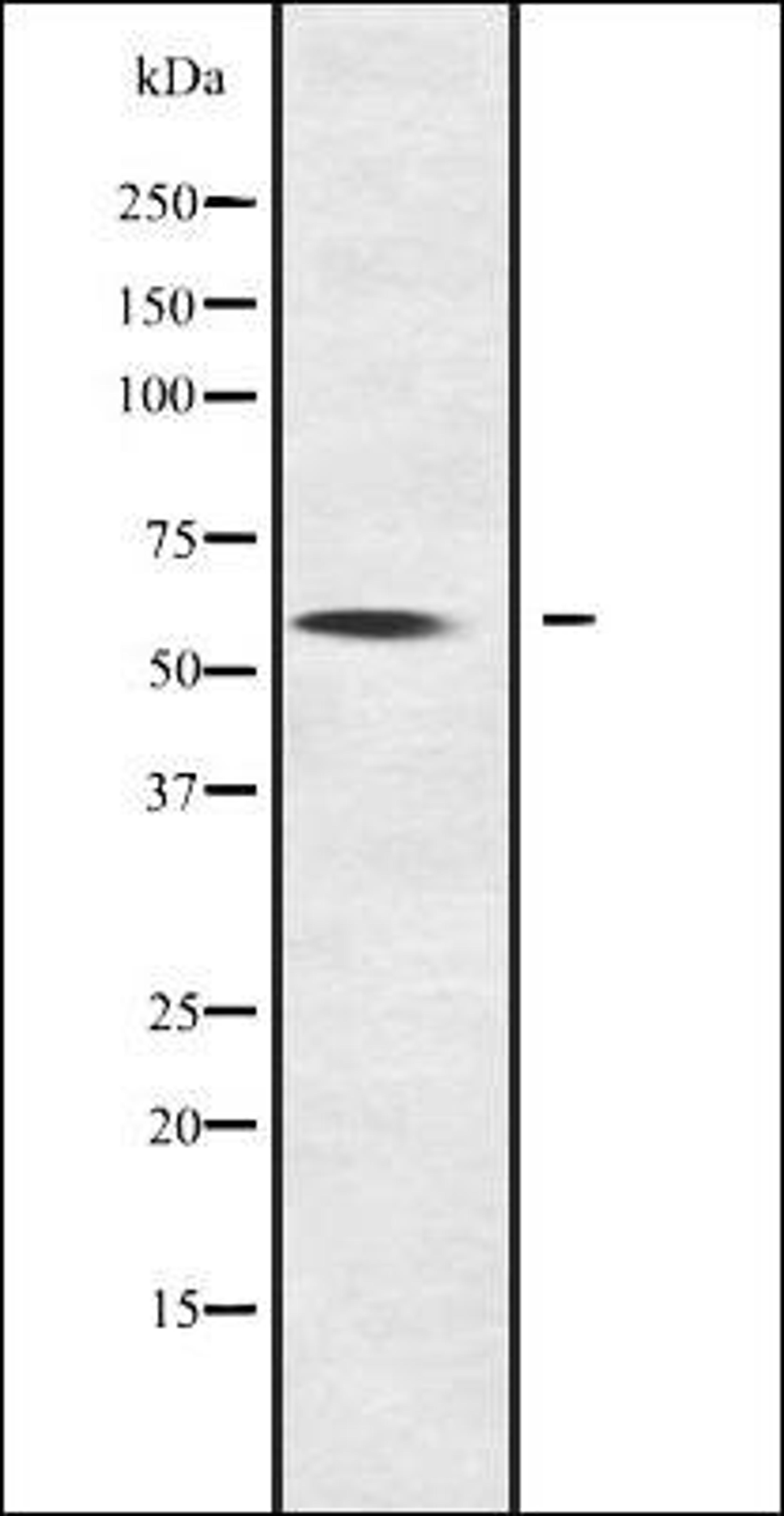 Western blot analysis of NOC4L transfected 293T cell lysate using NOC4L antibody