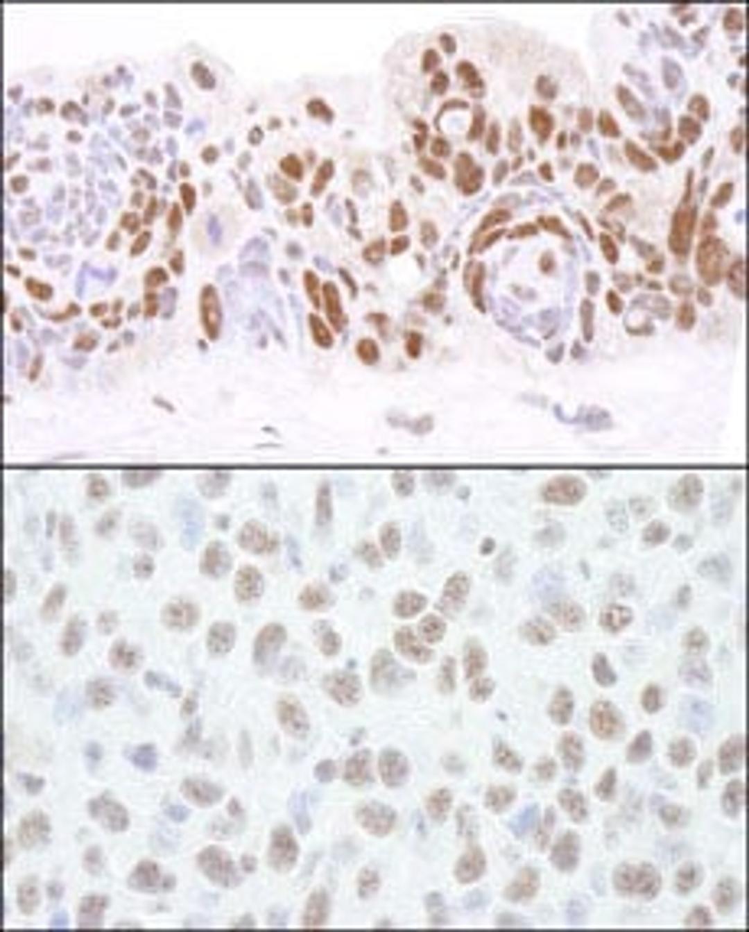 Detection of human and mouse HDAC1 by immunohistochemistry.