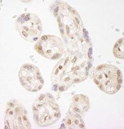 Detection of human NELFA by immunohistochemistry.