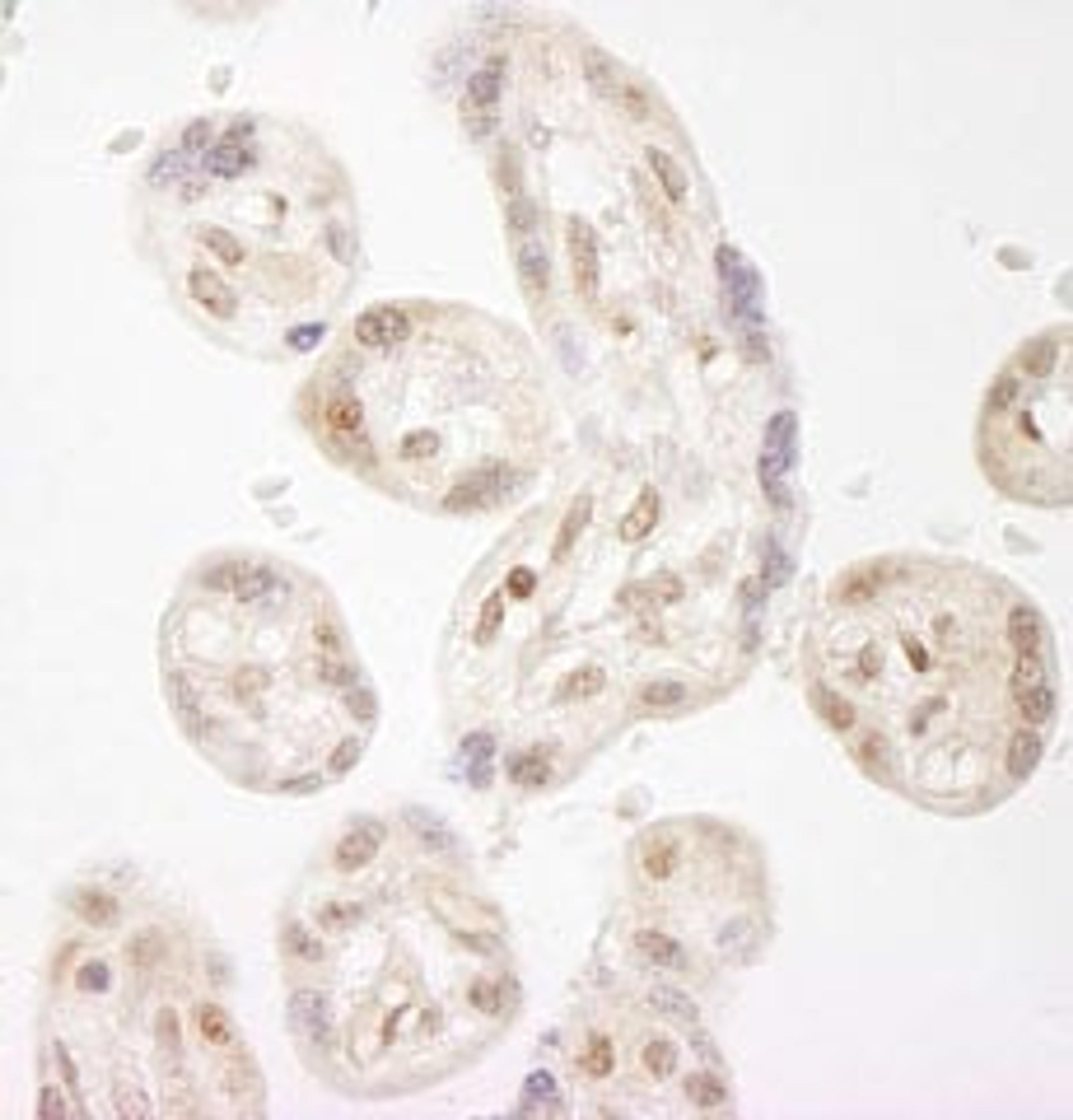 Detection of human NELFA by immunohistochemistry.