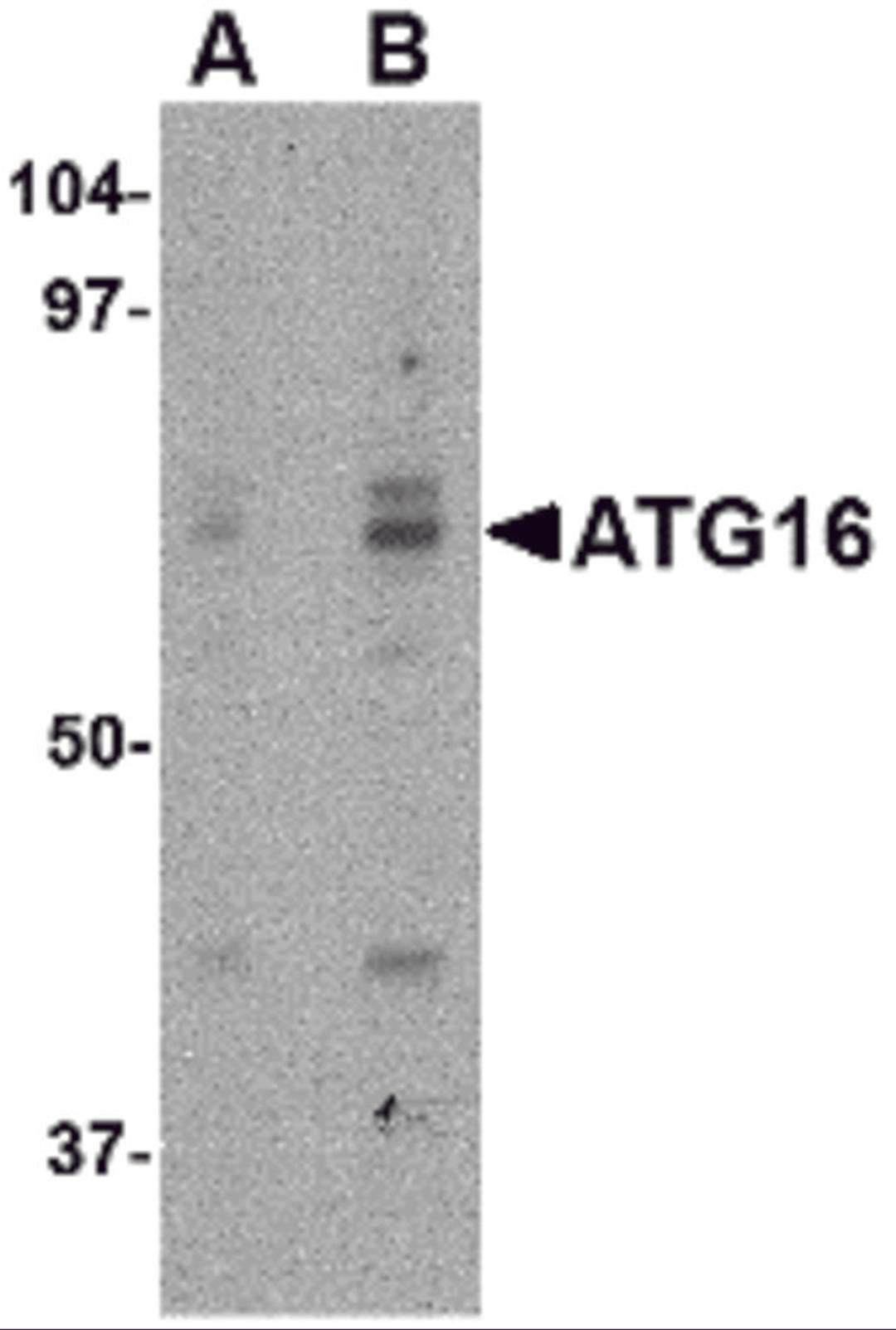 Western blot analysis of ATG16 in HeLa cell lysate with ATG16 antibody at (A) 0.25 and (B) 0.5 μg/mL.