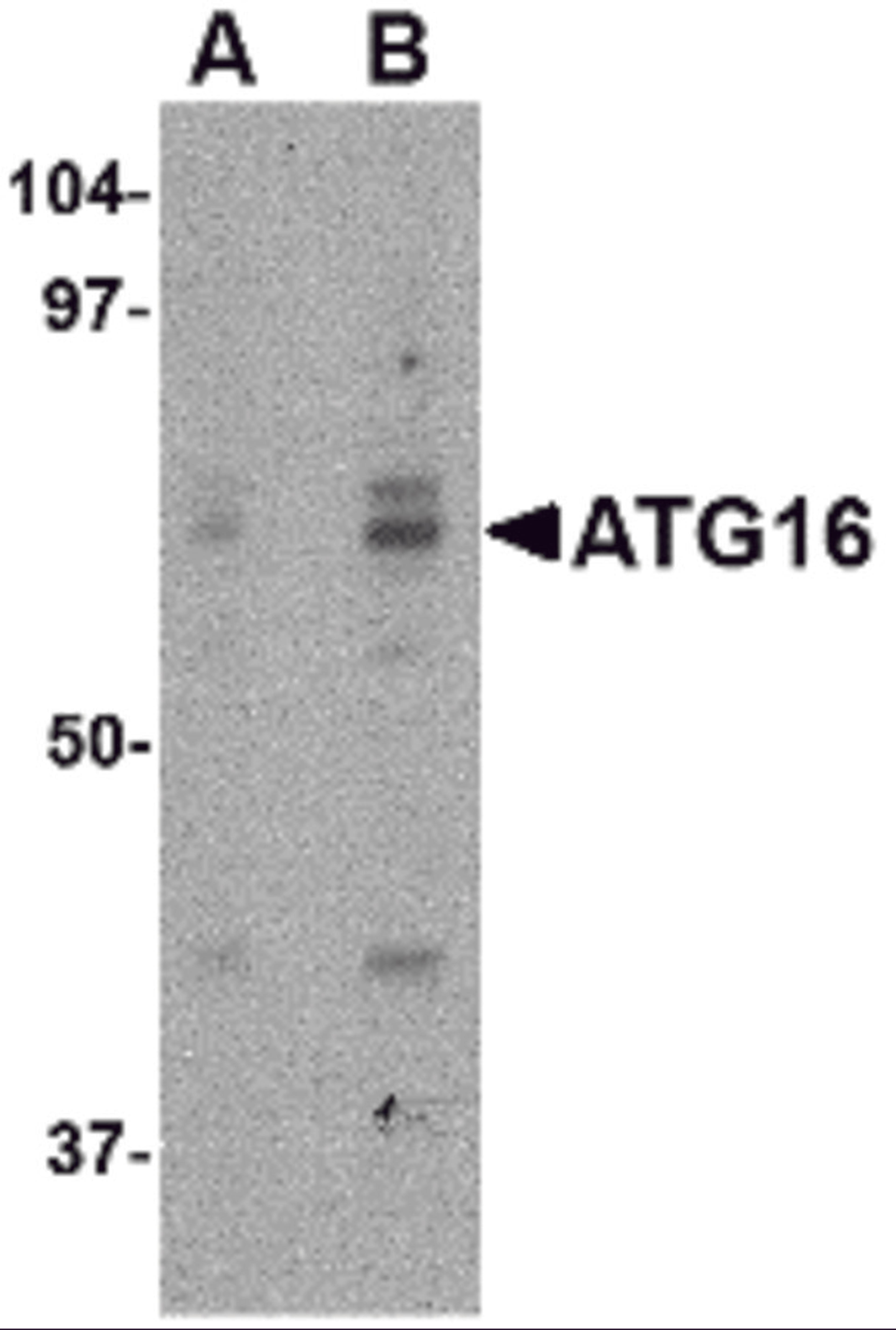 Western blot analysis of ATG16 in HeLa cell lysate with ATG16 antibody at (A) 0.25 and (B) 0.5 μg/mL.