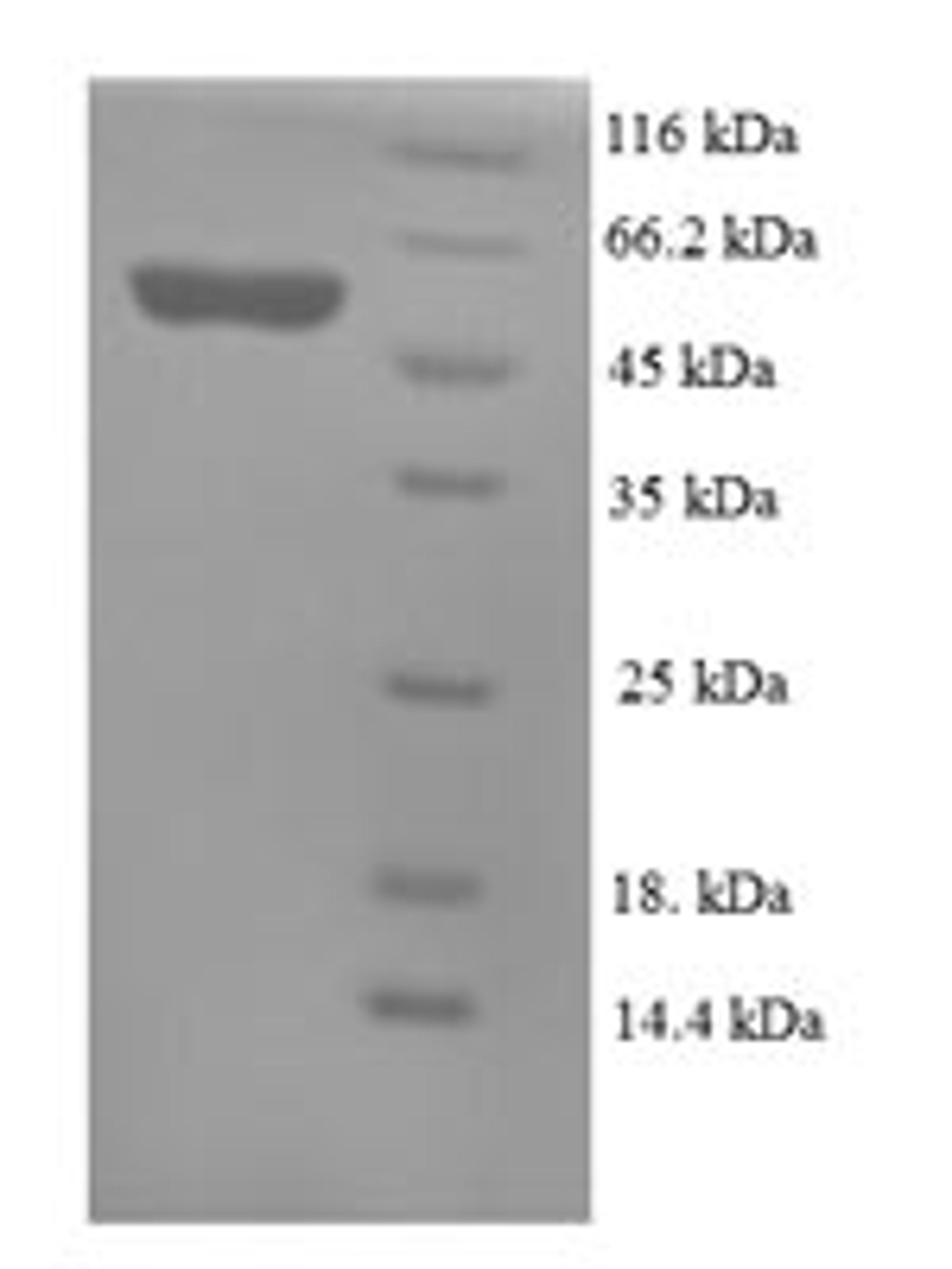 (Tris-Glycine gel) Discontinuous SDS-PAGE (reduced) with 5% enrichment gel and 15% separation gel.
