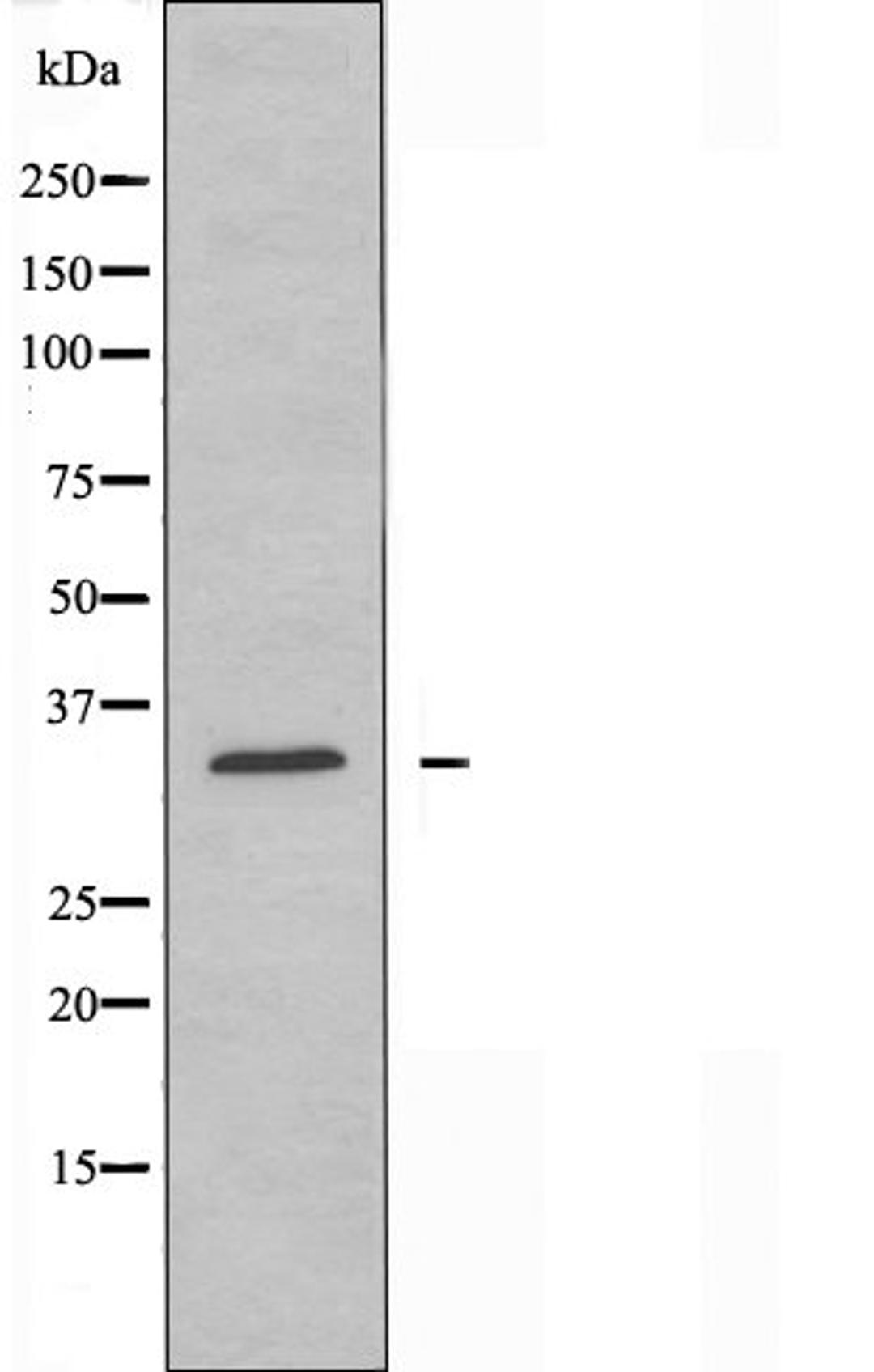 Western blot analysis of HeLa cells and COLO cells using CLTR2 antibody