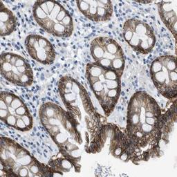 Immunohistochemistry-Paraffin: Integrin alpha 6/CD49f Antibody [NBP1-85747] - Staining of human rectum shows moderate cytoplasmic and membranous positivity in glandular cells.