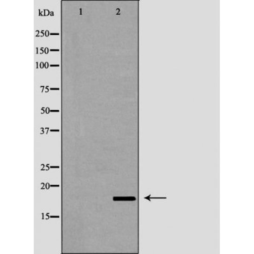 Western blot analysis of 721_B cell lysate using LCN6 antibody