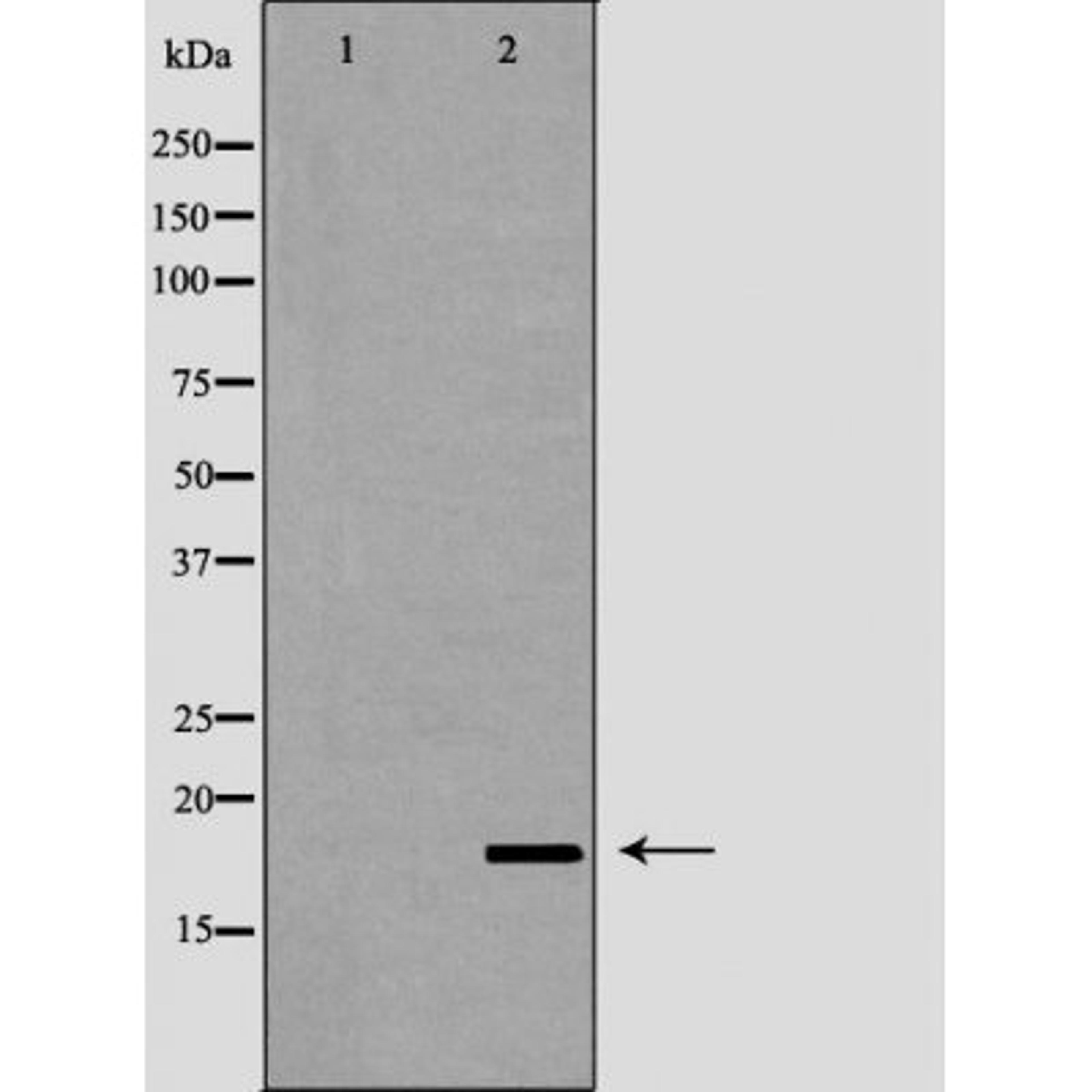 Western blot analysis of 721_B cell lysate using LCN6 antibody