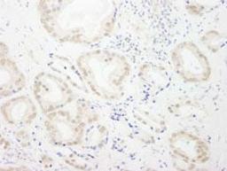 Detection of human GTF3C4/TFIIIC90 by immunohistochemistry.