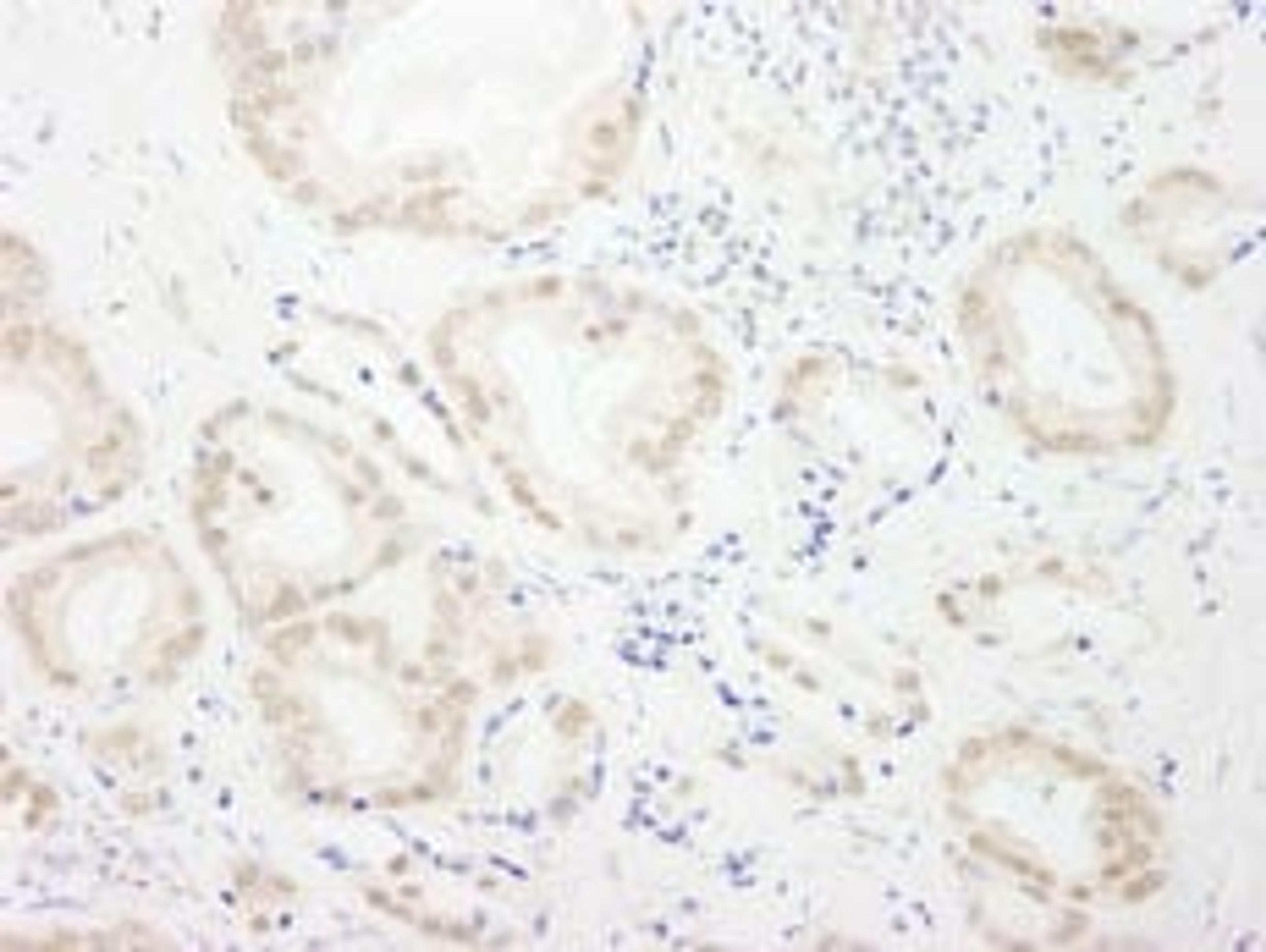 Detection of human GTF3C4/TFIIIC90 by immunohistochemistry.