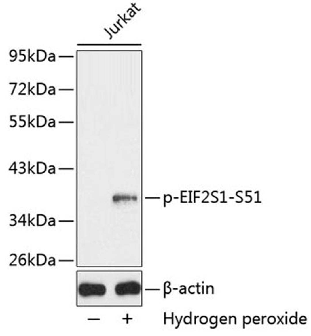 Western blot - Phospho-EIF2S1-S51 antibody (AP0342)