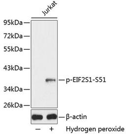 Western blot - Phospho-EIF2S1-S51 antibody (AP0342)