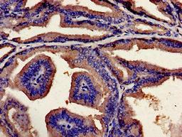 Immunohistochemistry analysis of human prostate tissue using CSB-PA883393LA01HU at dilution of 1:100