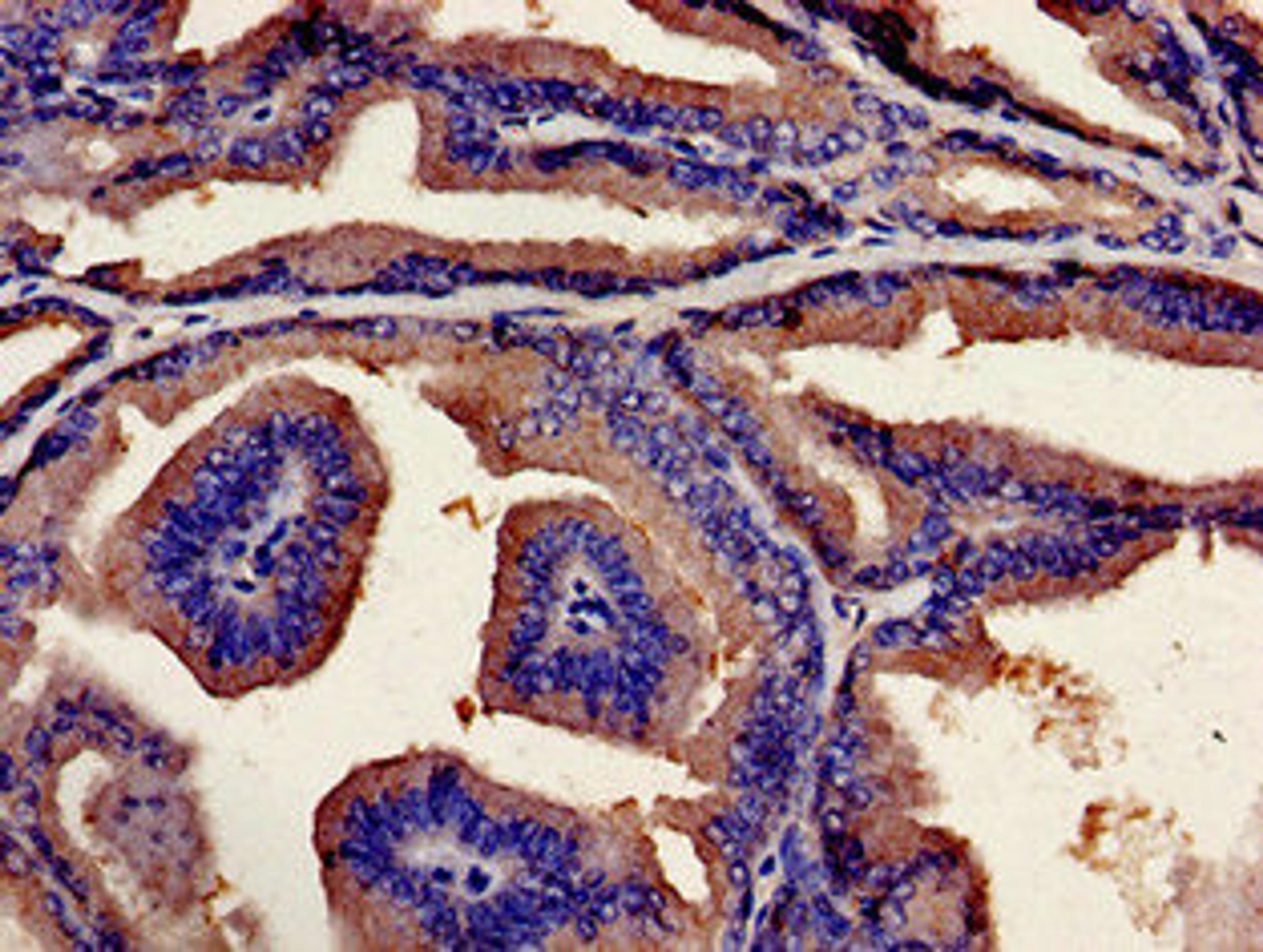Immunohistochemistry analysis of human prostate tissue using CSB-PA883393LA01HU at dilution of 1:100