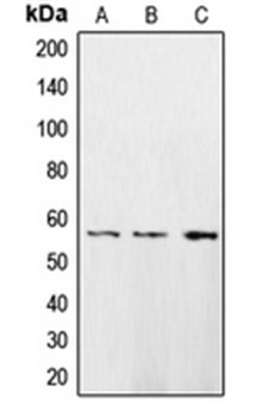 Western blot analysis of HeLa (Lane 1), A431 (Lane 2), H1299 (Lane 3) whole cell lysates using CAMK2D antibody