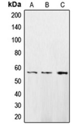 Western blot analysis of HeLa (Lane 1), A431 (Lane 2), H1299 (Lane 3) whole cell lysates using CAMK2D antibody