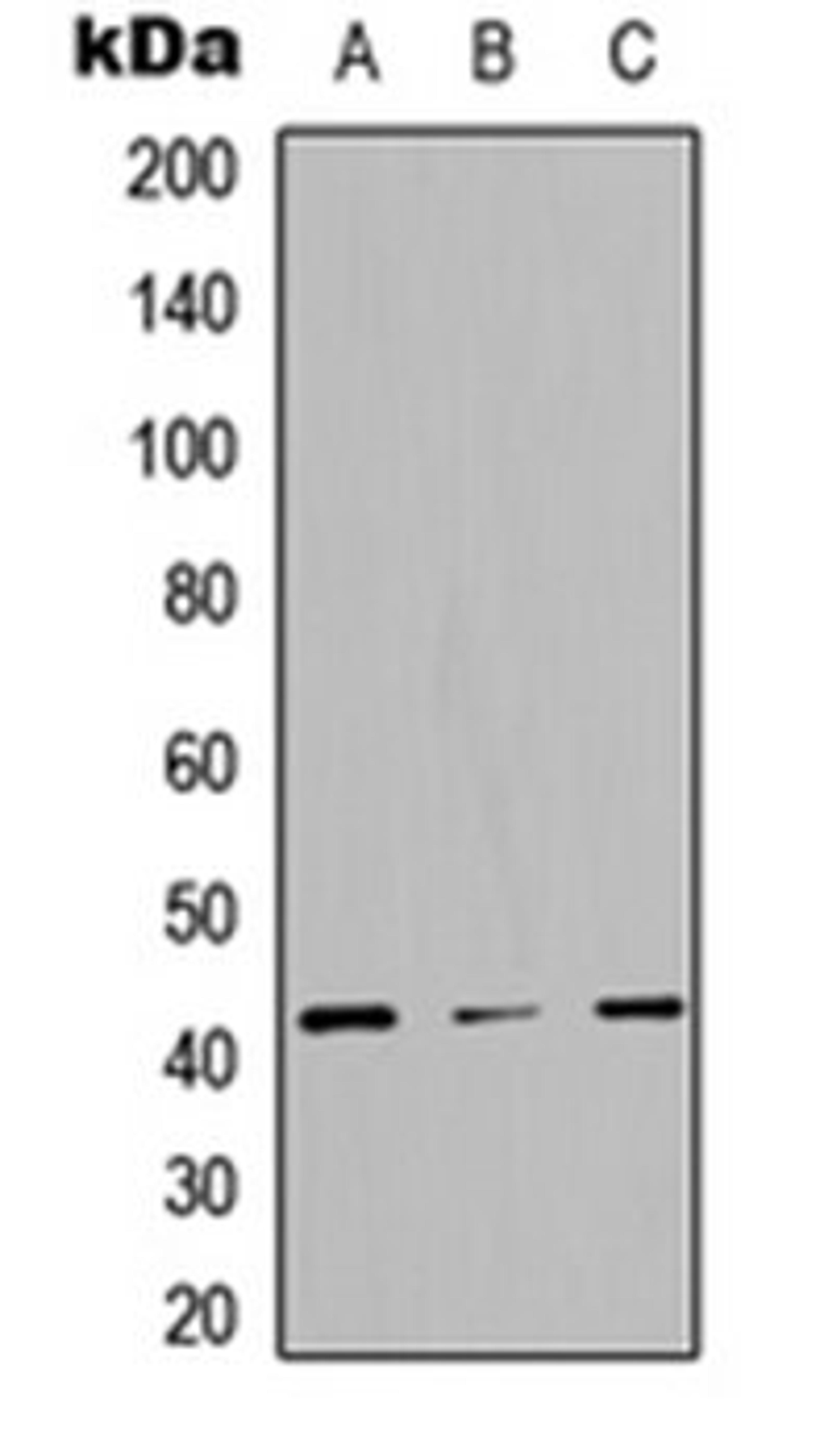 Western blot analysis of HEK293T (Lane 1), NS-1 (Lane 2), PC12 (Lane 3) whole cell lysates using STAC3 antibody