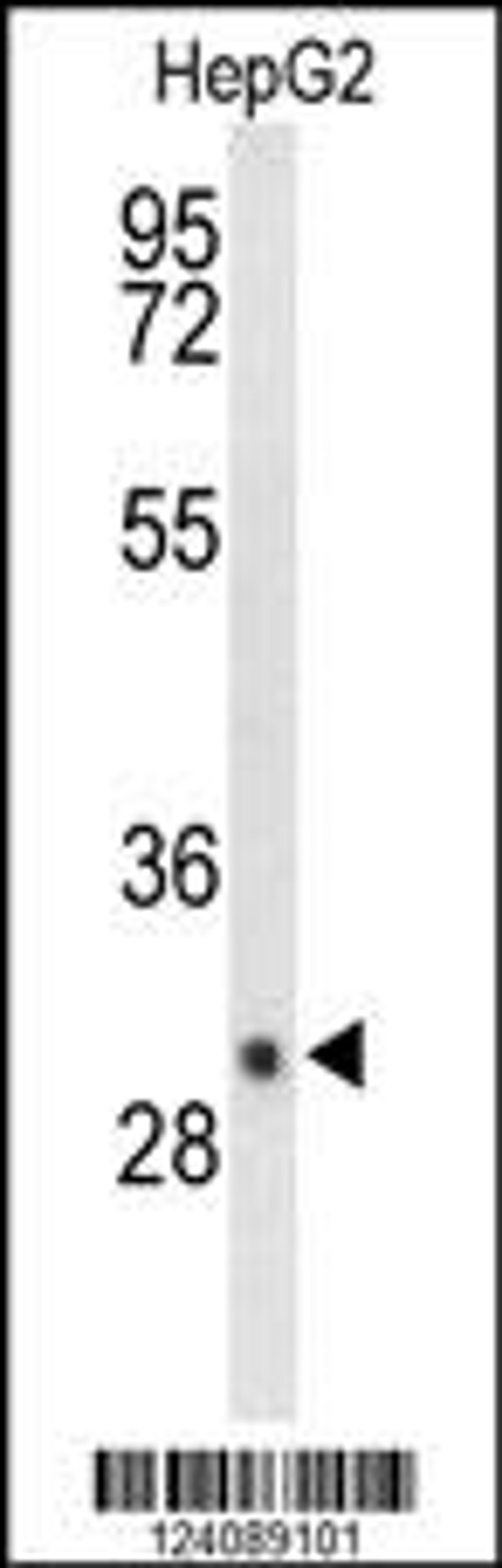 Western blot analysis of DIO3 Antibody in HepG2 cell line lysates (35ug/lane)