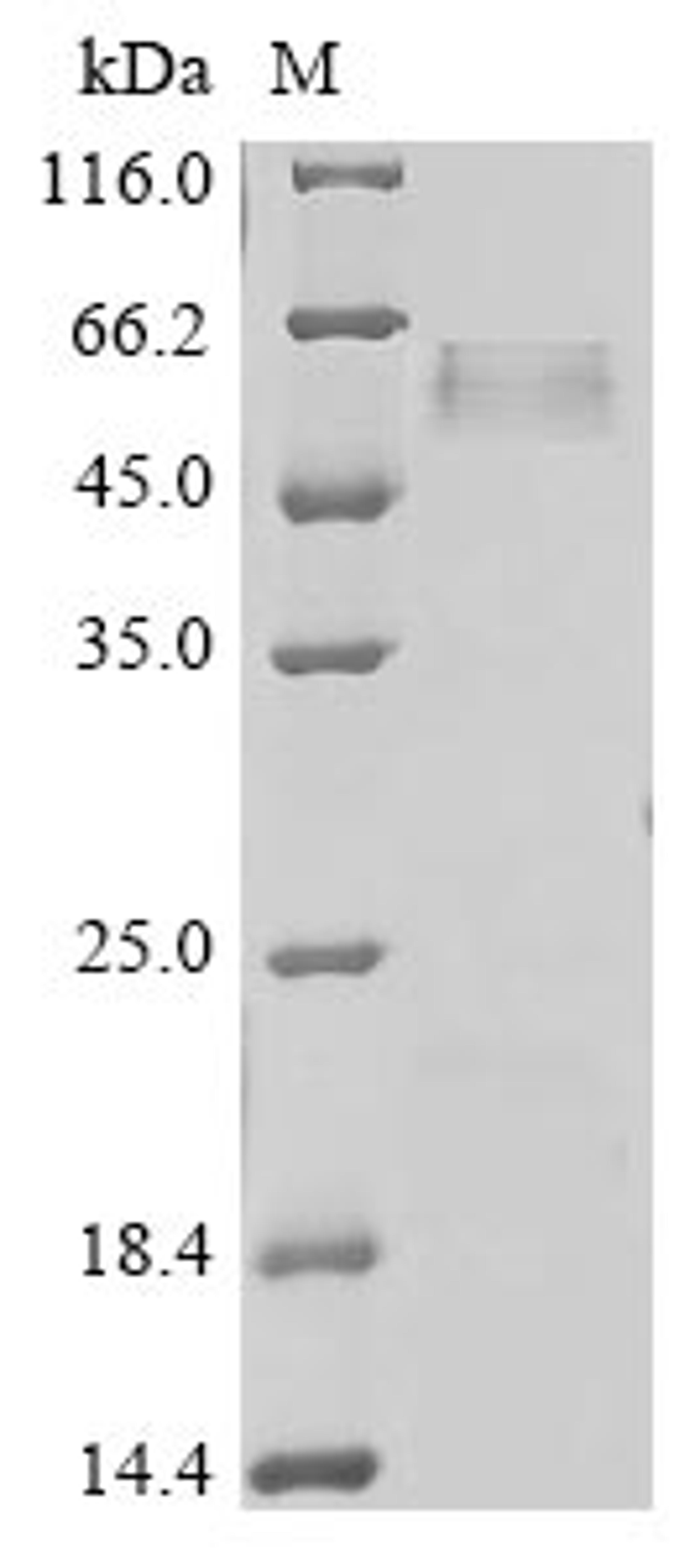 (Tris-Glycine gel) Discontinuous SDS-PAGE (reduced) with 5% enrichment gel and 15% separation gel.