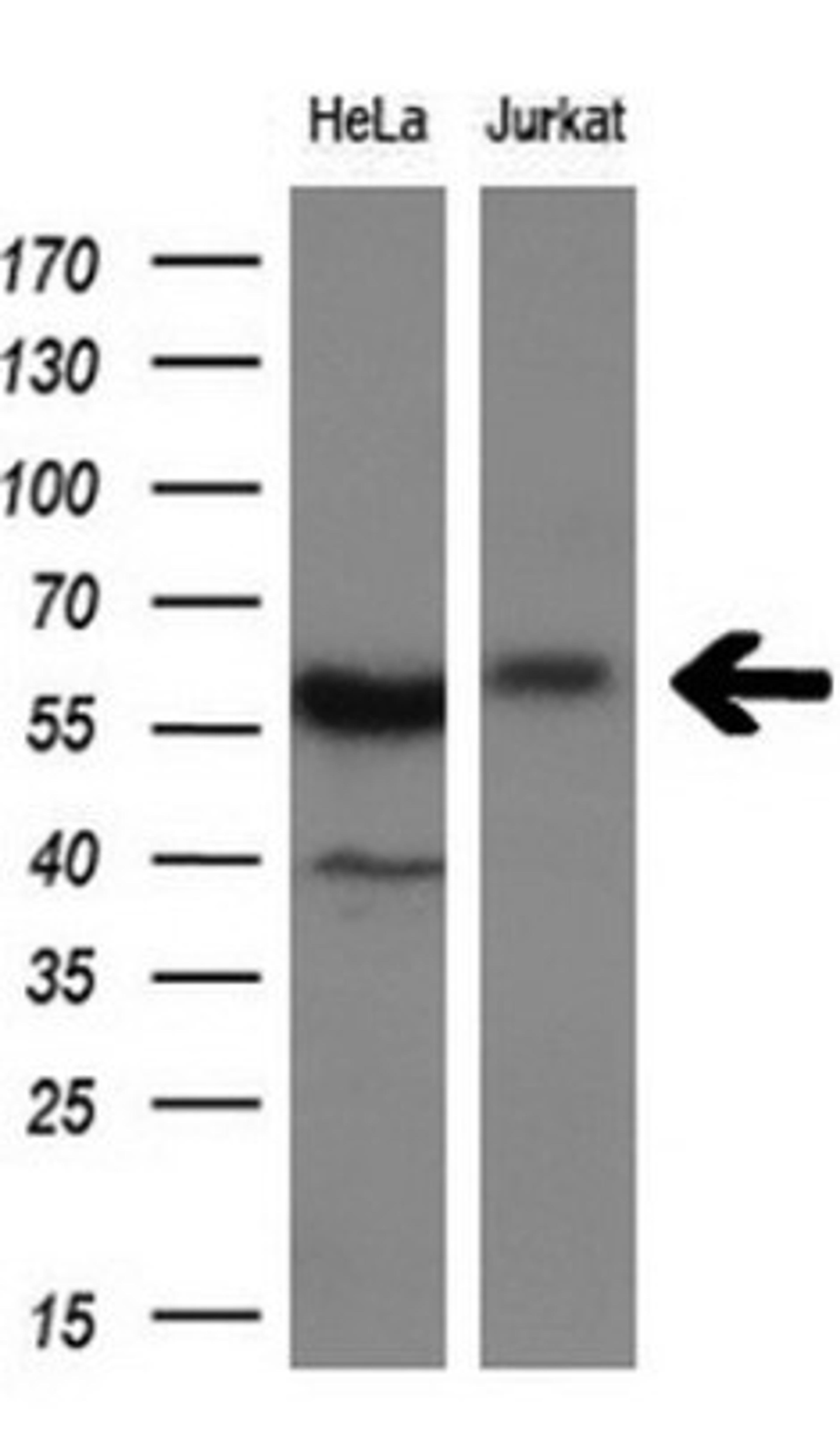 Western Blot: DYNC1LI1 Antibody (2E8) [NBP2-45682] - Analysis of extracts (10ug) from HeLa and Jurkat cell lines.