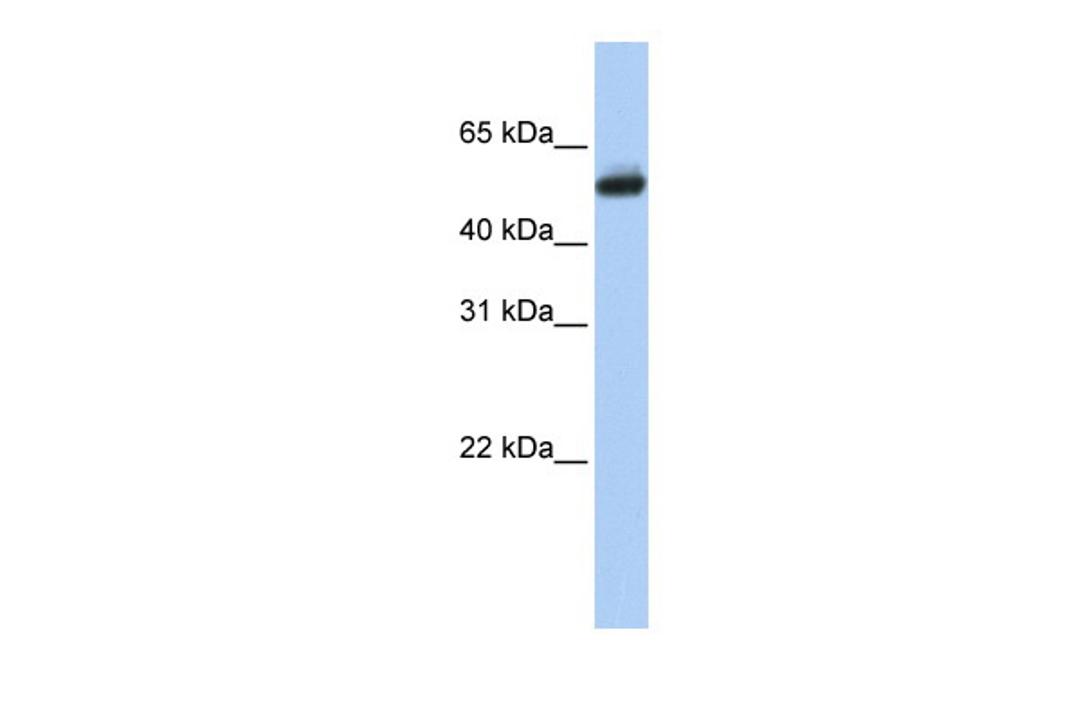 Antibody used in WB on Human Brain at 0.2-1 ug/ml.