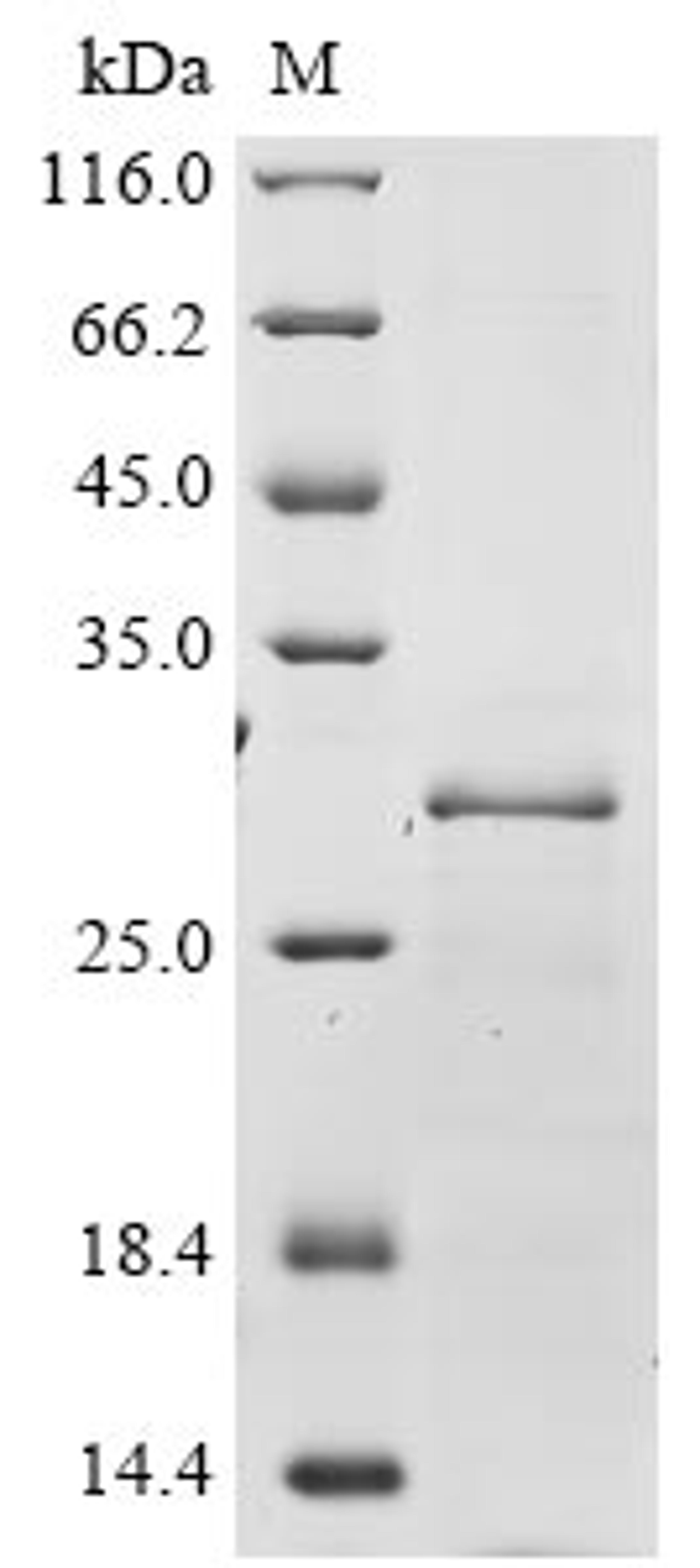 (Tris-Glycine gel) Discontinuous SDS-PAGE (reduced) with 5% enrichment gel and 15% separation gel.