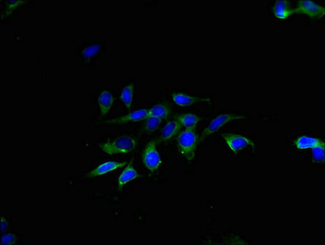 Immunofluorescent analysis of Hela cells using CSB-PA023836LA01HU at dilution of 1:100 and Alexa Fluor 488-congugated AffiniPure Goat Anti-Rabbit IgG(H+L)