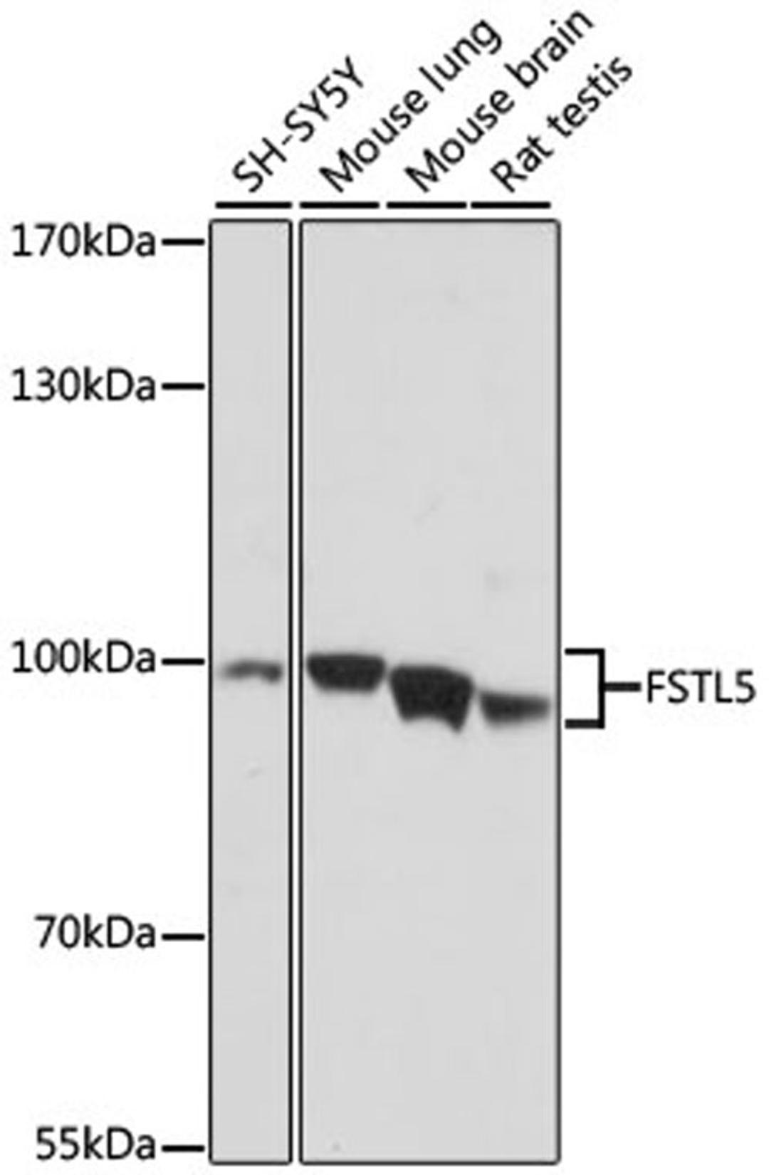 Western blot - FSTL5 antibody (A16553)