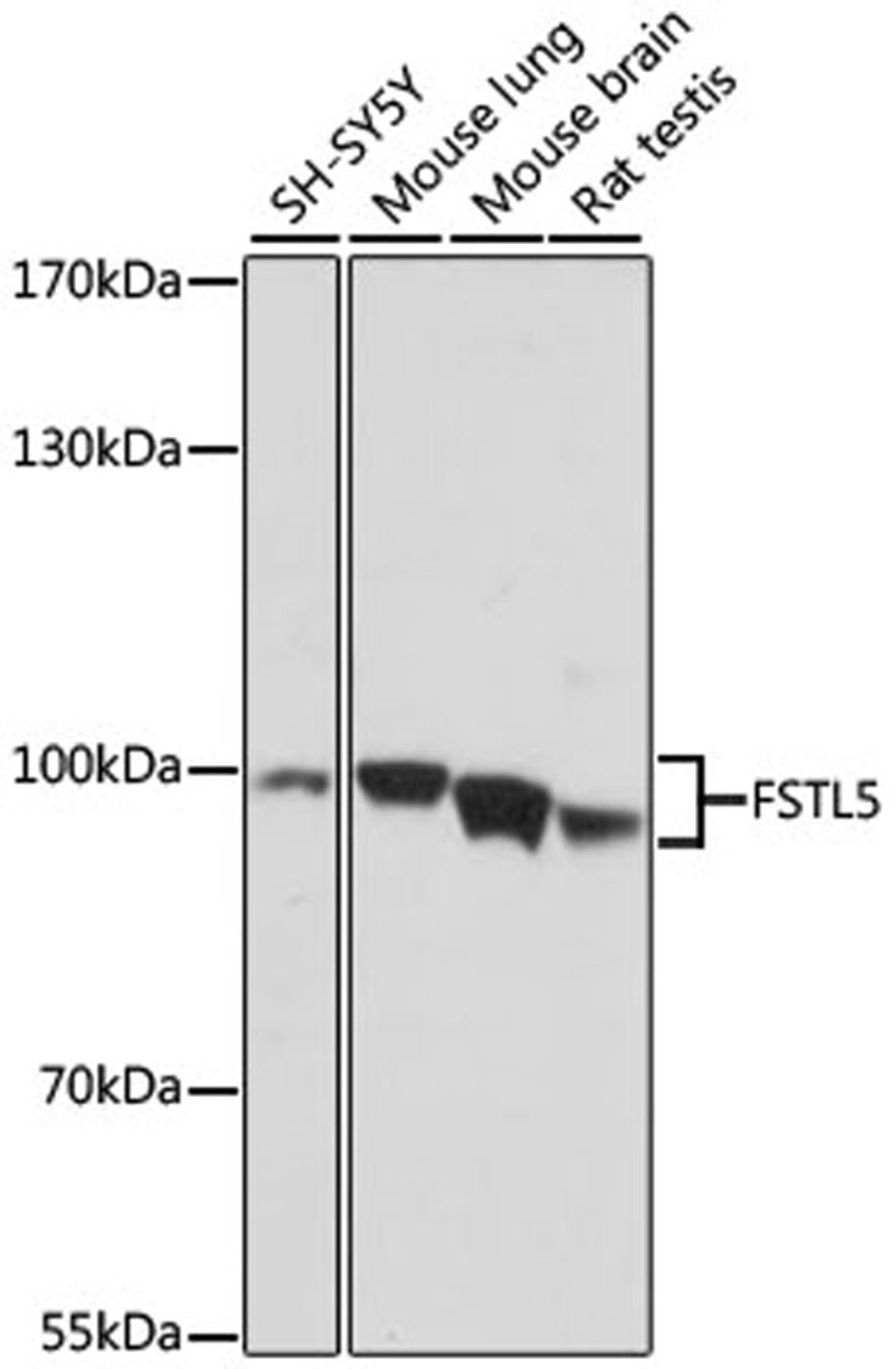 Western blot - FSTL5 antibody (A16553)