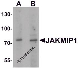 Western blot analysis of JAKMIP1 in rat brain tissue lysate with JAKMIP1 antibody at (A) 1 and (B) 2 μg/mL