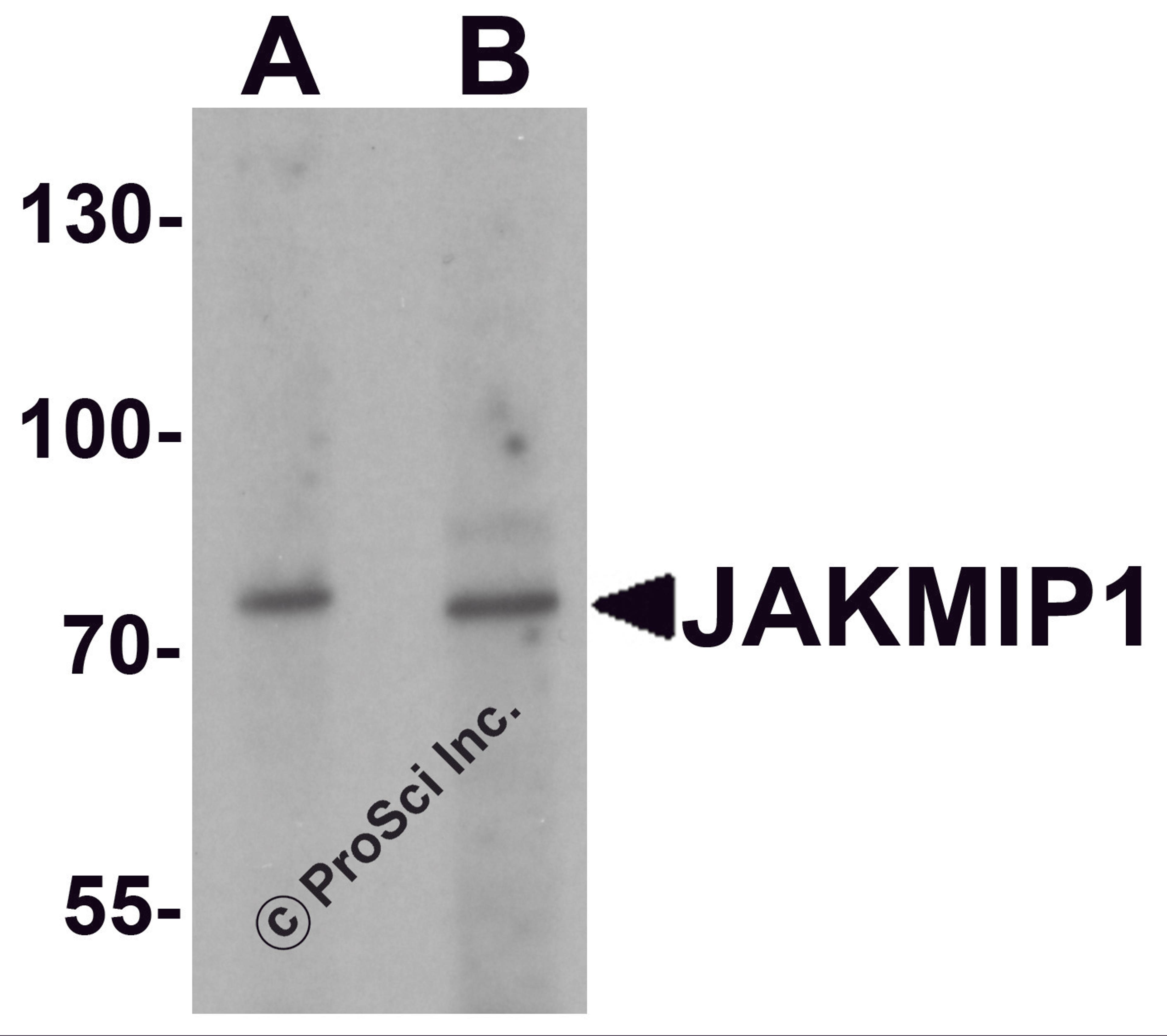 Western blot analysis of JAKMIP1 in rat brain tissue lysate with JAKMIP1 antibody at (A) 1 and (B) 2 μg/mL