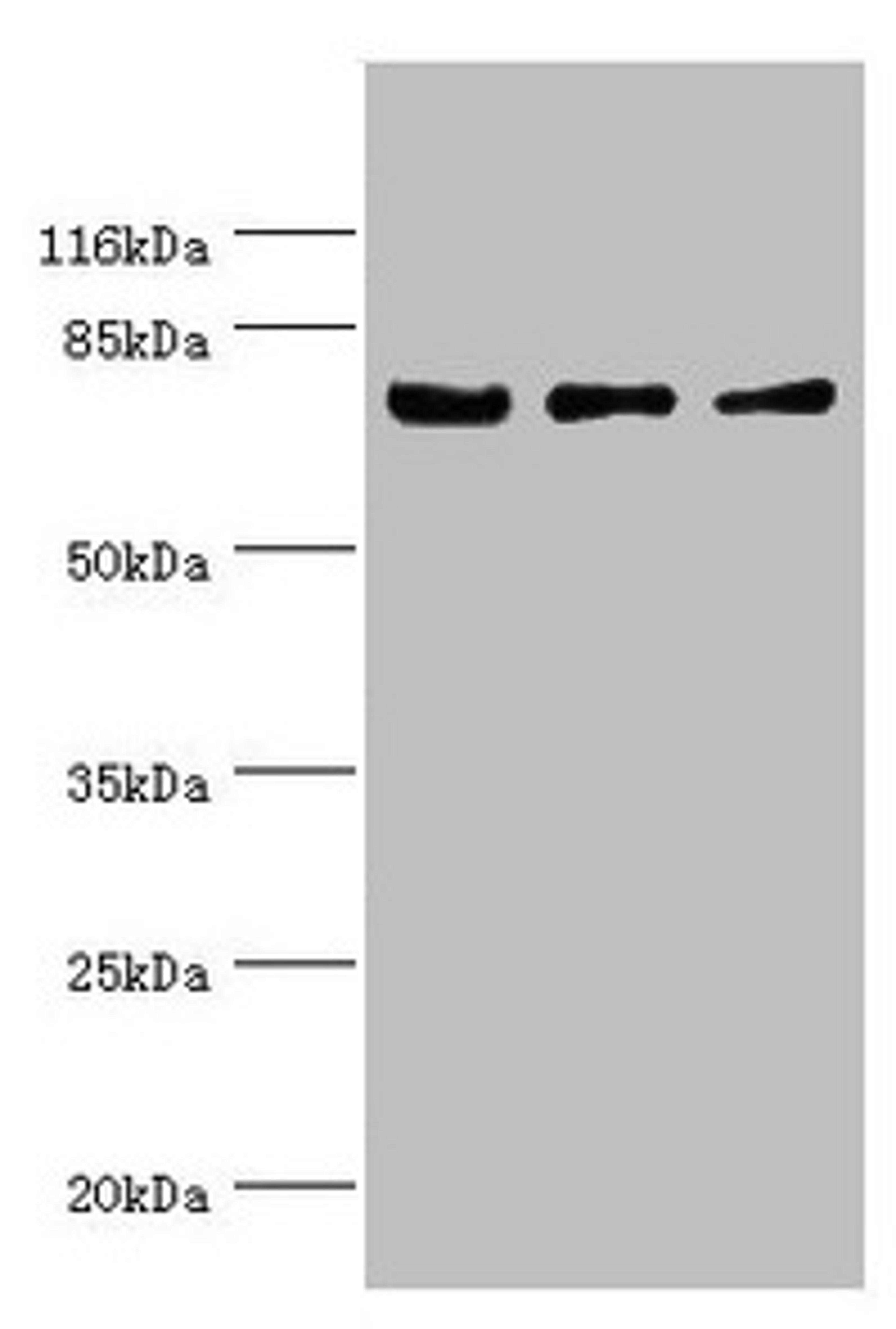 Western blot. All lanes: KLC1 antibody at 1.34µg/ml. Lane 1: Colo320 whole cell lysate. Lane 2: HepG2 whole cell lysate. Lane 3: SH-SY5Y whole cell lysate. Secondary. Goat polyclonal to rabbit IgG at 1/10000 dilution. Predicted band size: 66, 64, 65, 72, 70, 67, 63, 73 kDa. Observed band size: 72 kDa