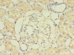 Immunohistochemistry of paraffin-embedded human kidney tissue using CSB-PA855068LA01HU at dilution of 1:100