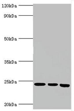 Western blot. All lanes: BAG family molecular chaperone regulator 2 antibody at 6ug/ml. Lane 1: Jurkat whole cell lysate. Lane 2: Hela whole cell lysate. Lane 3: HepG2 whole cell lysate. Secondary. Goat polyclonal to rabbit IgG at 1/10000 dilution. Predicted band size: 24, 21 kDa. Observed band size: 24 kDa.