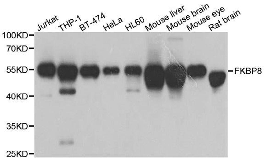 Western blot analysis of extracts of various cell lines using FKBP8 antibody