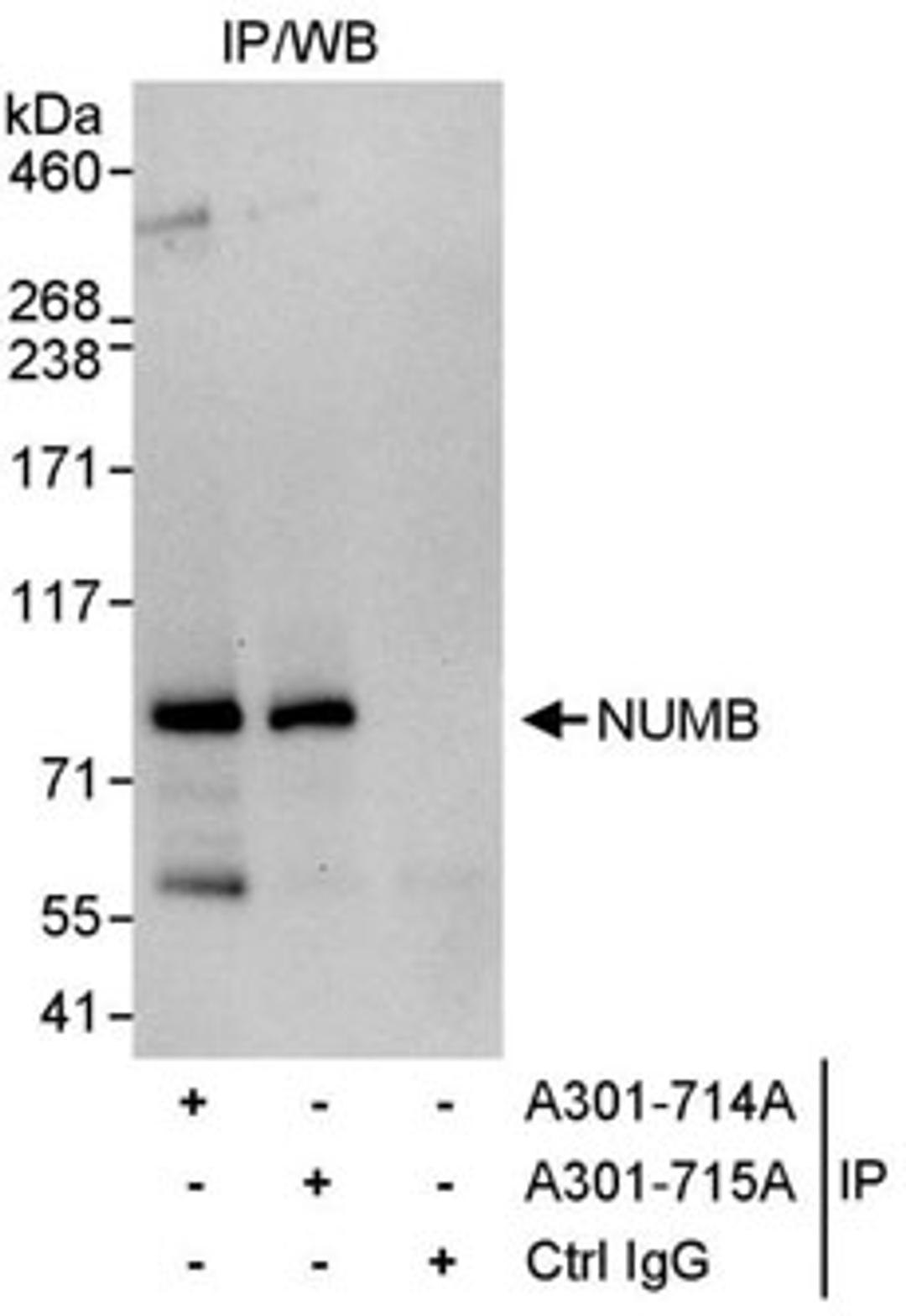 Detection of human NUMB by western blot of immunoprecipitates.