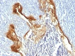 Formalin-fixed, paraffin-embedded human tonsil stained with Involucrin antibody (IVRN/827)