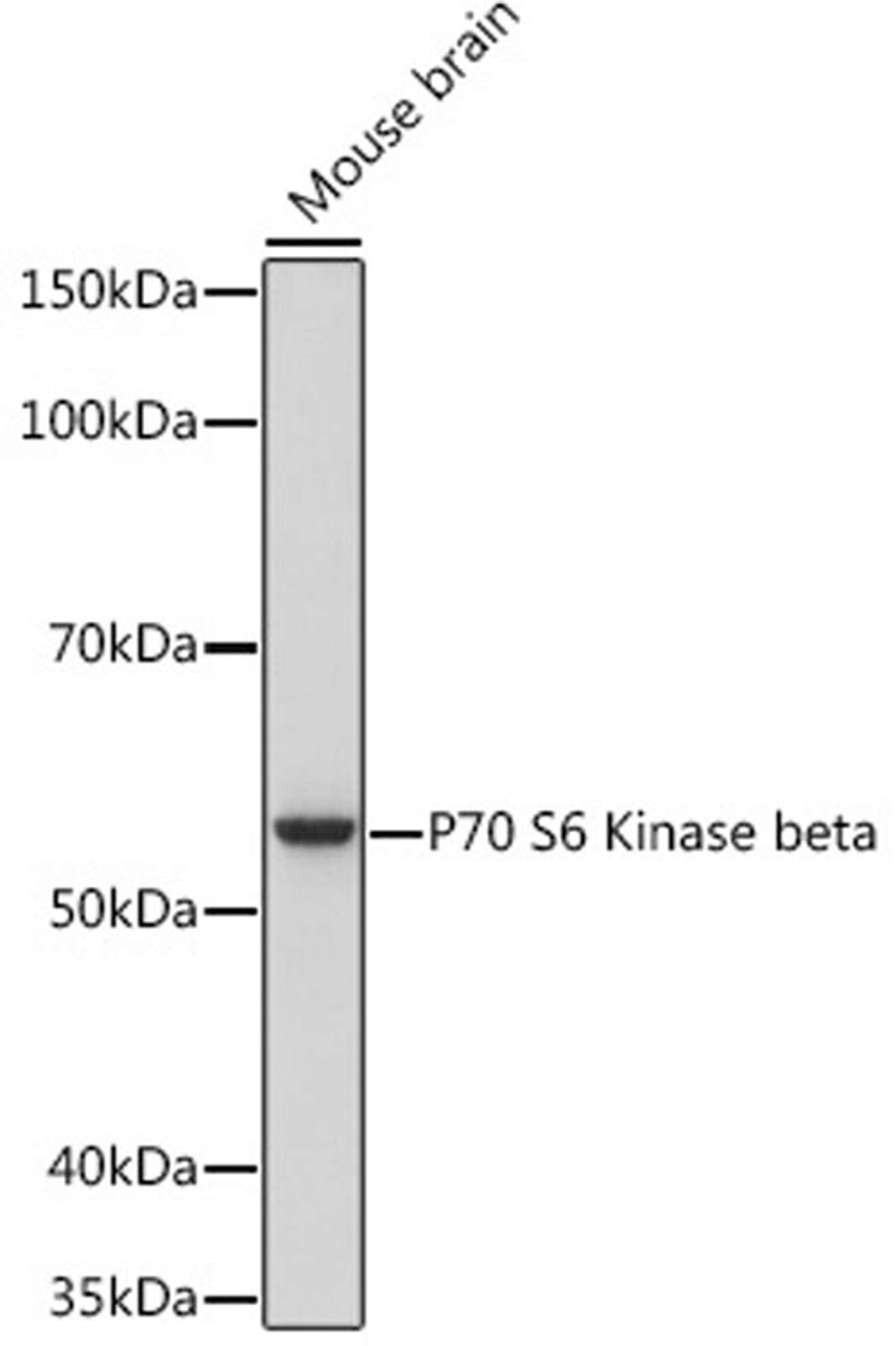 Western blot - P70 S6 Kinase beta Rabbit mAb (A9100)