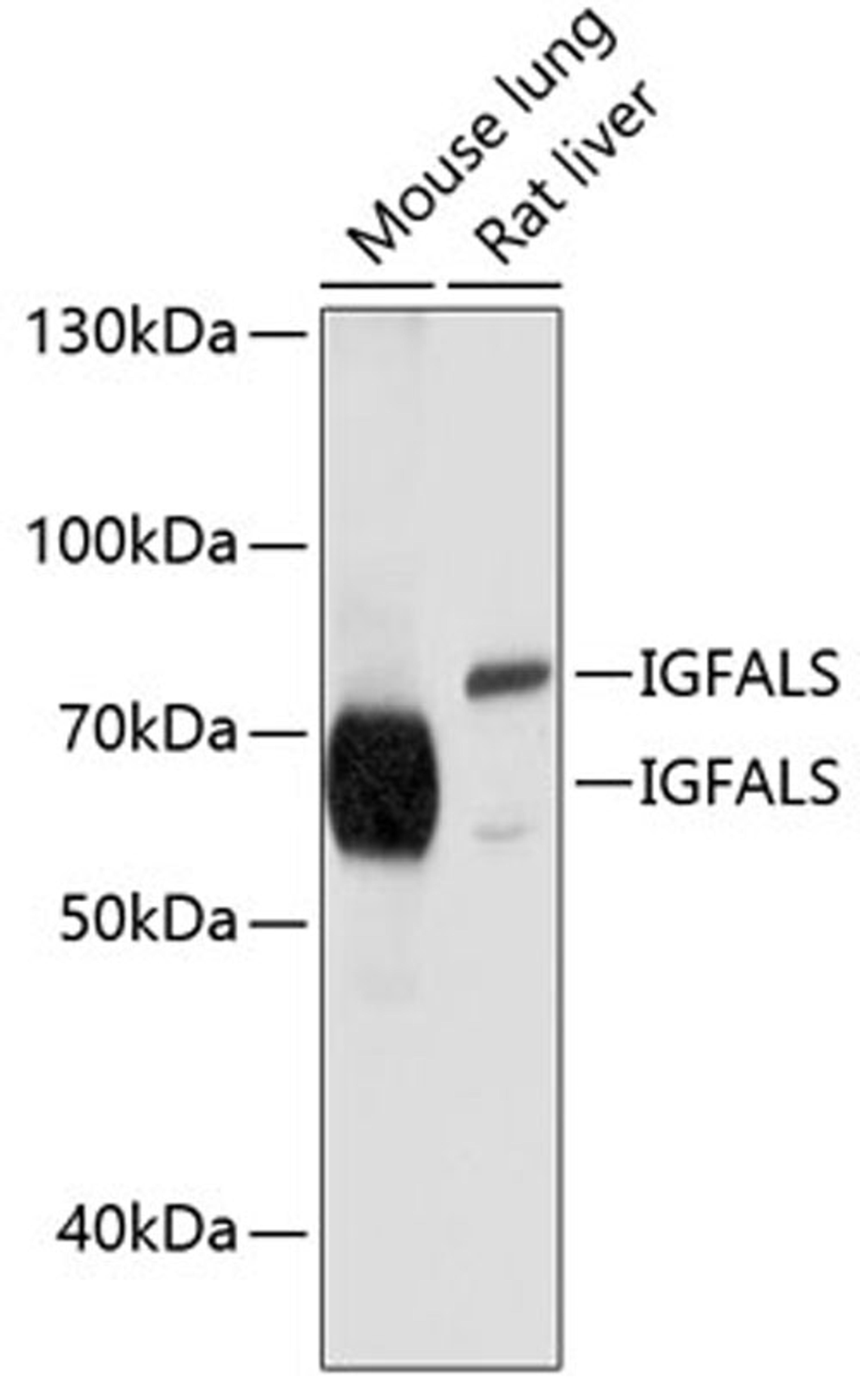 Western blot - IGFALS antibody (A10223)