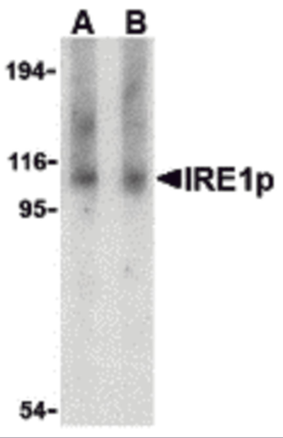 Western blot analysis of IRE1p in Raji cell lysate with IRE1p antibody at (A) 1 and (B) 2 &#956;g/mL.