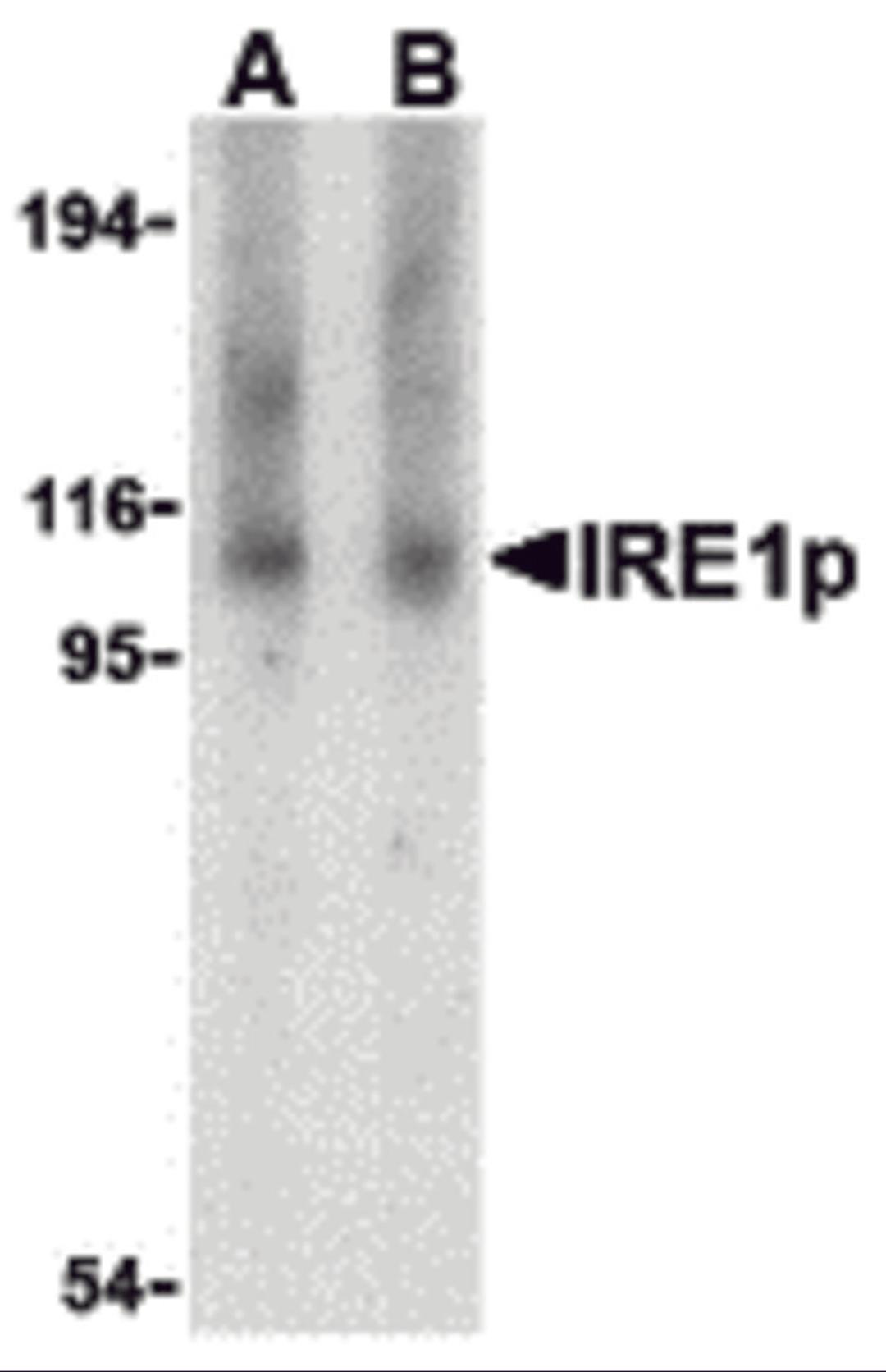 Western blot analysis of IRE1p in Raji cell lysate with IRE1p antibody at (A) 1 and (B) 2 μg/mL.