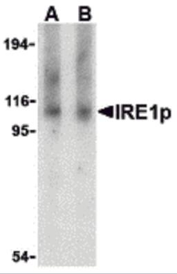 Western blot analysis of IRE1p in Raji cell lysate with IRE1p antibody at (A) 1 and (B) 2 μg/mL.