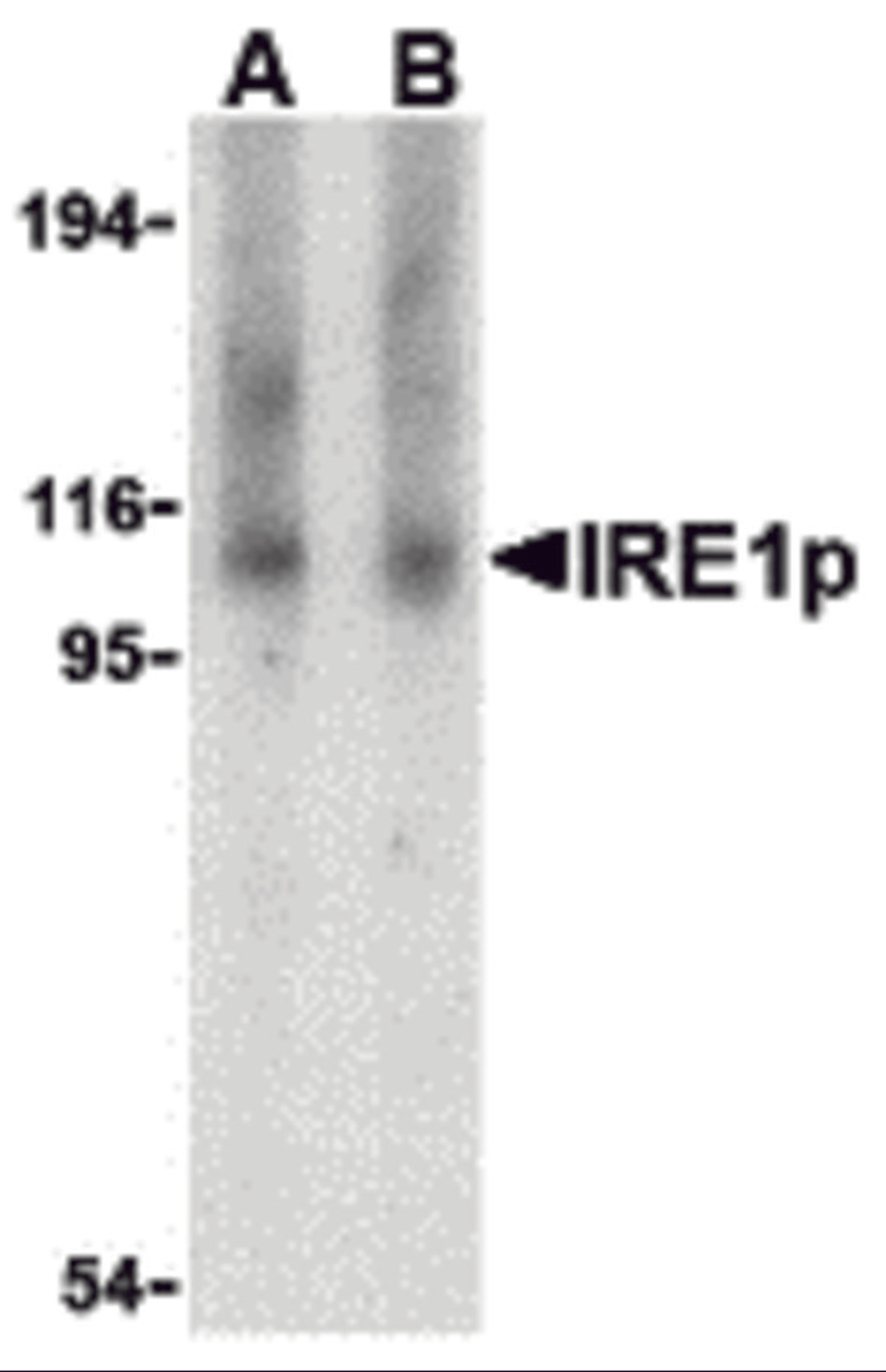 Western blot analysis of IRE1p in Raji cell lysate with IRE1p antibody at (A) 1 and (B) 2 μg/mL.